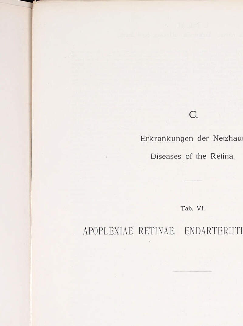 Erkrankungen der Netzhaul Diseases of the Retina. Tab. VI. APOPLEXIAE RETINAE. ENDARTERIITI