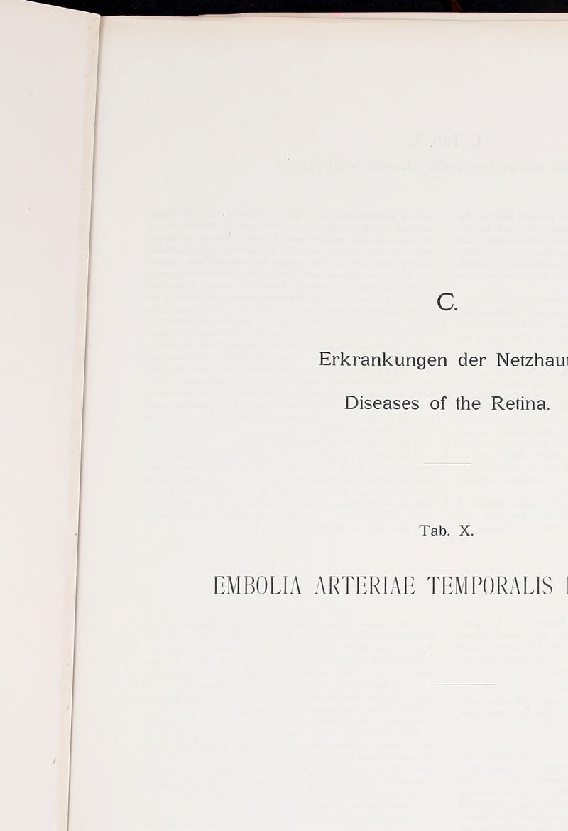 Erkrankungen der Netzhaui Diseases of the Retina. Tab. X. EMBOLIA ARTERIAE TEMPORALIS ]