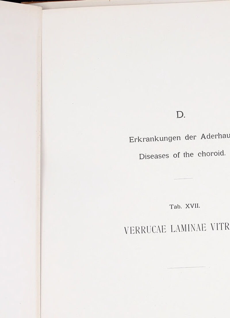 Erkrankungen der Aderhau Diseases of the choroid. Tab. XVII. VERRUCAE LAMINAE VITR