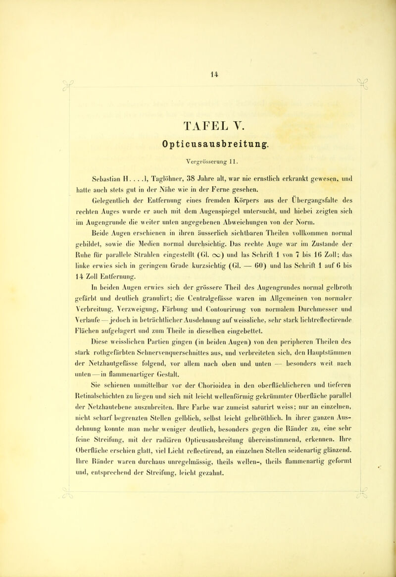 TAFEL Y. Opticusausbreitung. Vergrösserung 11. Sebastian H. .......1, Taglöhner, 38 Jahre alt, war nie ernstlich erkrankt gewesen, und hatte auch stets gut in der Nähe wie in der Ferne gesehen. Gelegentlich der Entfernung eines fremden Körpers aus der Ubergangsfalte des rechten Auges wurde er auch mit dem Augenspiegel untersucht, und hiebei zeigten sich im Augengrunde die weiter unten angegebenen Abweichungen von der Norm. Beide Augen erschienen in ihren äusserlich sichtbaren Theilen vollkommen normal gebildet, sowie die Medien normal durchsichtig. Das rechte Auge war im Zustande der Ruhe für parallele Strahlen eingestellt (Gl. oo) und las Schrift 1 von 7 bis 16 Zoll; das linke erwies sich in geringem Grade kurzsichtig (Gl. — 60) und las Schrift 1 auf 6 bis 14 Zoll Entfernung. In beiden Augen erwies sich der grössere Theil des Augengrundes normal gelbroth gefärbt und deutlich granulirt; die Centralgefässe waren im Allgemeinen von normaler Verbreitung, Verzweigung, Färbung und Contourirung von normalem Durchmesser und Verlaufe—jedoch in beträchtlicher Ausdehnung auf weissliche, sehr stark lichtreflectirende Flächen aufgelagert und zum Theile in dieselben eingebettet. Diese weisslichen Partien gingen (in beiden Augen) von den peripheren Theilen des stärk rothgefärbten Sehnervenquerschnittes aus, und verbreiteten sich, den Hauptstämmen der Netzhautgefasse folgend, vor allem nach oben und unten — besonders weit nach unten — in flammenartiger Gestalt. Sie schienen unmittelbar vor der Chorioidea in den oberflächlicheren und tieferen Retinalschichten zu liegen und sich mit leicht wellenförmig gekrümmter Oberfläche parallel der Netzhautebene auszubreiten. Ihre Farbe war zumeist saturirt weiss; nur an einzelnen, nicht scharf begrenzten Stellen gelblich, selbst leicht gelbröthlich. In ihrer ganzen Aus- dehnung konnte man mehr weniger deutlich, besonders gegen die Ränder zu, eine sehr feine Streifung, mit der radiären Opticusausbreitung übereinstimmend, erkennen. Ihre Oberfläche erschien glatt, viel Licht reflectirend, an einzelnen Stellen seidenartig glänzend. Ihre Ränder waren durchaus unregelmässig, theils wellen-, theils flammenartig geformt und, entsprechend der Streifung, leicht gezahnt.