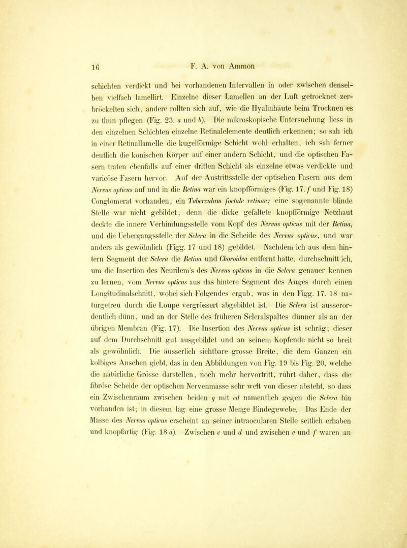 schichten verdickt und bei vorhandenen Intervallen in oder zwischen densel- ben vielfach lamellui. Einzelne dieser Lamellen an der Luft getrocknet zer- bröckelten sich, andere rollten sich auf, wie die HyaMnhäute beim Trocknen es zu thun pflegen (Fig. 23. a und h). Die mikroskopische Untersuchung üess in den einzelnen Schichten einzelne Retinalelemente deuthch erkennen; so sah ich in einer Retinailamelle die kugelförmige Schicht wohl erhalten, ich sah ferner deuthch die konischen Körper auf einer andern Schicht, und die optischen Fa- sern traten ebenfalls auf einer dritten Schicht als einzelne etwas verdickte und varicöse Fasern hervor. Auf der Austrittsstelle der optischen Fasern aus dem Nervus optiais auf und in die Retina war ein knopfförmiges (Fig. 17. f und Fig. 18) Conglomerat vorhanden, ein Tuherculum foetale retinae; eine sogenannte blinde Stelle war nicht gebildet; denn die dicke gefaltete knopfförmige Netzhaut deckte die innere Verbindungsstelle vom Kopf des Nervus opticus mit der Retina, und die Uebergangsstelle der Sclera in die Scheide des Nervus opticus, und war anders als gewöhnlich (Figg. 17 und 18) gebildet. Nachdem ich aus dem liin- tern Segment der Sclera die Retina und Choroidea entfernt hatte, durchschnitt ich, um die Insertion des Neurilem's des Nervus opticus in die Sclera genauer kennen zu lernen, vom Nervus opticus aus das liintere Segment des Auges durch einen Longitudinalschnitt, wobei sich Folgendes ergab, was in den Figg. 17. 18 na- turgetreu durch die Loupe vergrössert abgebildet ist. Die Sclera ist ausseror- dentlich dünn, und an der Stelle des früheren Scleralspaltes dünner als an der übrigen Membran (Fig. 17). Die Insertion des Nervus opticus ist schräg; dieser auf dem Durchschnitt gut ausgebildet und an seinem Kopfende nicht so breit als gewöhnlich. Die äusserlich sichtbare grosse Breite, die dem Ganzen ein kolbiges Ansehen giebt, das in den Abbildungen von Fig. 19 bis Fig. 20, welche die natürliche Grösse darstellen, noch mehr hervortritt, rührt daher, dass die fibröse Scheide der optischen Nervenmasse sehr weit von dieser absteht, so dass ein Zwischenraum zwischen beiden g mit cd namentüch gegen die Sclera hin vorhanden ist; in diesem lag eine grosse Menge Bindegewebe, Das Ende der Masse des Nervus opticus erscheint an seiner intraocularen Stelle seithch erhaben und knopfartig (Fig. 18 a). Zwischen c und d und zwischen e und f waren an