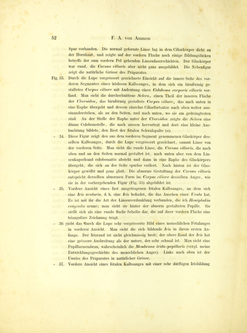 52 F. A. von Amnion Spur vorhanden. Die normal geformte Linse lag in dem Ciliarkörper dicht an der Hornhaut, und zeigte auf der vordem Fläche noch einige Bildungslücken betrefifs der zum vordem Pol gehenden Linsenfaserschichten. Der Glaskörper war rund, die Corona ciliaris aber nicht ganz ausgebildet. Die Nebenfigur zeigt die natMiche Grösse des Präparates. Fig. 33. Durch die Lupe vergrössert gezeichnete Einsicht auf die innere Seite des vor- deren Segmentes eines irislosen Kalbsauges, in dem sich ein birnförmig ge- staltetes Corpus ciliare mit Andeutung eines Colohoma corporis ciliaris vor- fand. Man sieht die durchschnittene Sclera, einen Theil der inneren Fläche der CJioi oidea, das birnförmig gestaltete Corpus ciliare, das nach unten in eine Raphe übergeht und dessen einzelne Ciliarfortsätze nach oben weiter aus- einanderstehen, als an den Seiten, und nach unten, wo sie am gedrängtesten sind. An der Stelle der Raphe unter der Choroidea zeigte die Sclera eine dünne Colobomstelle, die nach aussen hervortrat und dort eine kleine Aus- buchtung bildete, den Rest der fötalen Scleralspalte (a). - 34. Diese Figur zeigt den aus dem vorderen Segment genommenen Glaskörper des- selben Kalbsauges, durch die Lupe vergrössert gezeichnet, sammt Linse von der vorderen Seite. Man sieht die runde Linse, die Corona ciliaris, die nach oben und an den Seiten normal gestaltet ist, nach unten aber von dem Lin- senkapseh-and colobomatös absteht und dann in eine Raphe des Glaskörpers übergeht, die sich an der Seite spm-los verliert. Nach hinten ist der Glas- körper gewölbt und ganz glatt. Die abnorme Gestaltung der Corona ciliaris entspricht derselben abnormen Form im Corpus ciliare desselben Auges, wie sie in der vorhergehenden Figur (Fig. 33) abgebildet ist. - 35. Vordere Ansicht eines fast ausgetragenen fötalen Kalbsauges, an dem sich eine Iris wmlaria, d. h. eine Iris befindet, die das Ansehen einer Uvula hat. Es ist mit ihr die Art der Linsen Verdunklung verbunden, die ich Hemiphakia conf/cnita nenne; man sieht sie hinter der abnorm gestalteten Pupille. Sie stellt sich als eine runde flache Scheibe dar, die auf ilu*er vordem Fläche eine trianguläre Zeichnung trägt. - 36 giebt das tlurch die Lupe sehr vergrösserte Bild eines menschlichen Fötalauges in vorderer Ansicht. Man sieht die sich bildende Iris in ihrem ersten An- fange. Der Irisrand ist nicht gleichmässig breit; der obere Rand der Iris hat eine grössere Ausbreitung als der untere, der sehr schmal ist. Man sieht eine Pupillarmembran, wahrscheinlich die Membrana irido-pvpillaris (vergl. meine Entwicklungsgeschichte des menschlichen Auges). Links nach oben ist der Umriss des Präparates in natürlicher Grösse. - 37. Vordere Ansicht eines fötalen Kalbsauges mit einer sehr dürftigen Irisbildung