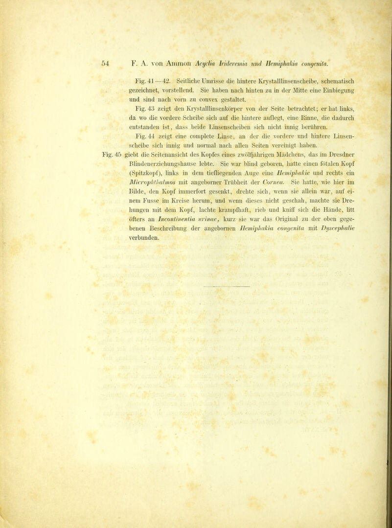 Fig. 41—42. Seitliche Umrisse die hintere Ki'ystalllinsenscheibe, schematisch gezeichnet, vorstellend. Sie haben nach hinten zu in der Mitte eine Einbiegung und sind nach vorn zu convex gestaltet. Fig. 43 zeigt den Krystalllinsenkörper von der Seite betrachtet; er hat links, da wo die vordere Scheibe sich auf die hintere auflegt, eine Rinne, die dadurch entstanden ist, dass beide Liusenscheiben sich nicht innig berühren. Fig. 44 zeigt eine complete Linse, an der die vordere und hintere Linsen- scheibe sich innig und normal nach allen Seiten vereinigt ■ haben. Fig. 45 giebt die Seiteuansicht des Kopfes eines zwölfjährigen Mädchens, das im Dresdner Blindenerzieliungshause lebte. Sie war blind geboren, hatte einen fötalen Kopf (Spitzkopf), links in dem tiefliegenden Auge eine Hemiphalde und rechts ein Microphtliahnos mit angeborner Trübheit der Cornea. Sie hatte, wie hier im Bilde, den Kopf immerfort gesenkt, drehte sich, wenn sie allein war, auf ei- nem Fusse im Kreise herum, und wenn dieses nicht geschah, machte sie Dre- hungen mit dem Kopf, lachte krampfhaft, rieb und kniff sich die Hände, litt öfters an Inconünentia nrinae, kurz sie war das Original zu der oben gege- benen Beschreibung der angebornen Hemiphakia congenita mit Dyscephalie verbunden.