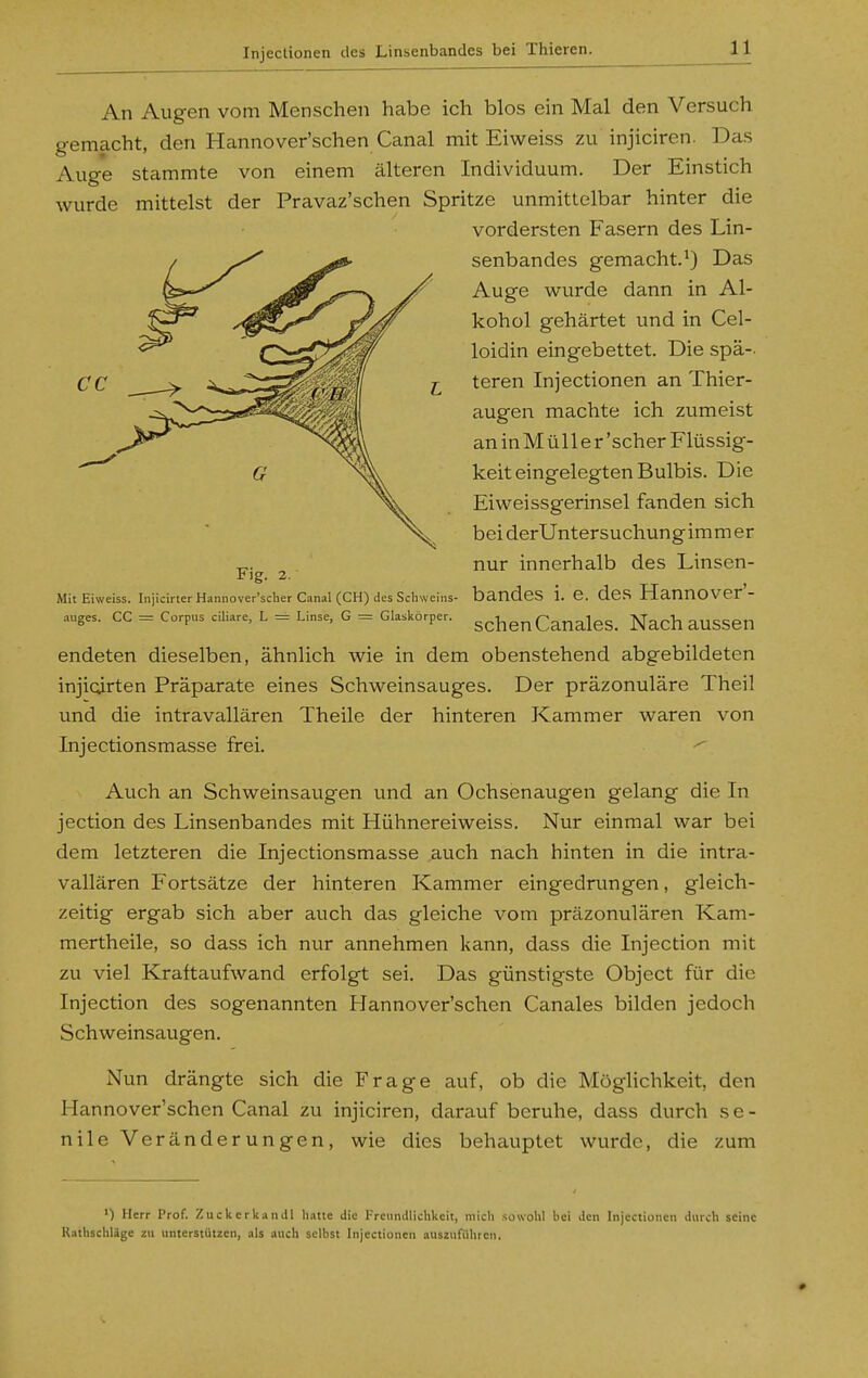 Injectionen des Linsenbandes bei Thieren. An Augen vom Menschen habe ich blos ein Mal den Versuch gemacht, den Hannover'schen Canal mit Eiweiss zu injiciren. Das Auge stammte von einem älteren Individuum. Der Einstich wurde mittelst der Pravaz'schen Spritze unmittelbar hinter die vordersten Fasern des Lin- senbandes gemacht.^) Das Auge wurde dann in Al- kohol gehärtet und in Cel- loidin eingebettet. Die spä- teren Injectionen an Thier- augen machte ich zumeist an in M ü 11 e r 'scher Flüssig- keit eingelegten Bulbis. Die Eiweissgerinsel fanden sich bei derUnter s uchun g im m e r nur innerhalb des Linsen- bandes i. e. des Hannover'- schen Canales. Nach aussen endeten dieselben, ähnlich wie in dem obenstehend abgebildeten injioirten Präparate eines Schweinsauges. Der präzonuläre Theil und die intravallären Theile der hinteren Kammer waren von Injectionsmasse frei. ^ Auch an Schweinsaugen und an Ochsenaugen gelang die In jection des Linsenbandes mit Hühnereiweiss. Nur einmal war bei dem letzteren die Injectionsmasse auch nach hinten in die intra- vallären Fortsätze der hinteren Kammer eingedrungen, gleich- zeitig ergab sich aber auch das gleiche vom präzonulären Kam- mertheile, so dass ich nur annehmen kann, dass die Injection mit zu viel Kraftaufwand erfolgt sei. Das günstigste Object für die Injection des sogenannten Hannover'schen Canales bilden jedoch Schweinsaugen. Nun drängte sich die Frage auf, ob die Möglichkeit, den Hannover'schen Canal zu injiciren, darauf beruhe, dass durch se- nile Veränderungen, wie dies behauptet wurde, die zum Fig. 2. Mit Eiweiss. Injicirter Hannover'scber Canal (CH) des Schweins- auges. CC = Corpus ciliare, L = Linse, G = Glaskörper. ') Herr Prof. ZuckerkanJl hatte die Freundlichkeit, micli sowohl hei den Injectionen durch seine Kathschlägc zu unterstützen, als auch selbst Injectionen auszuführen.