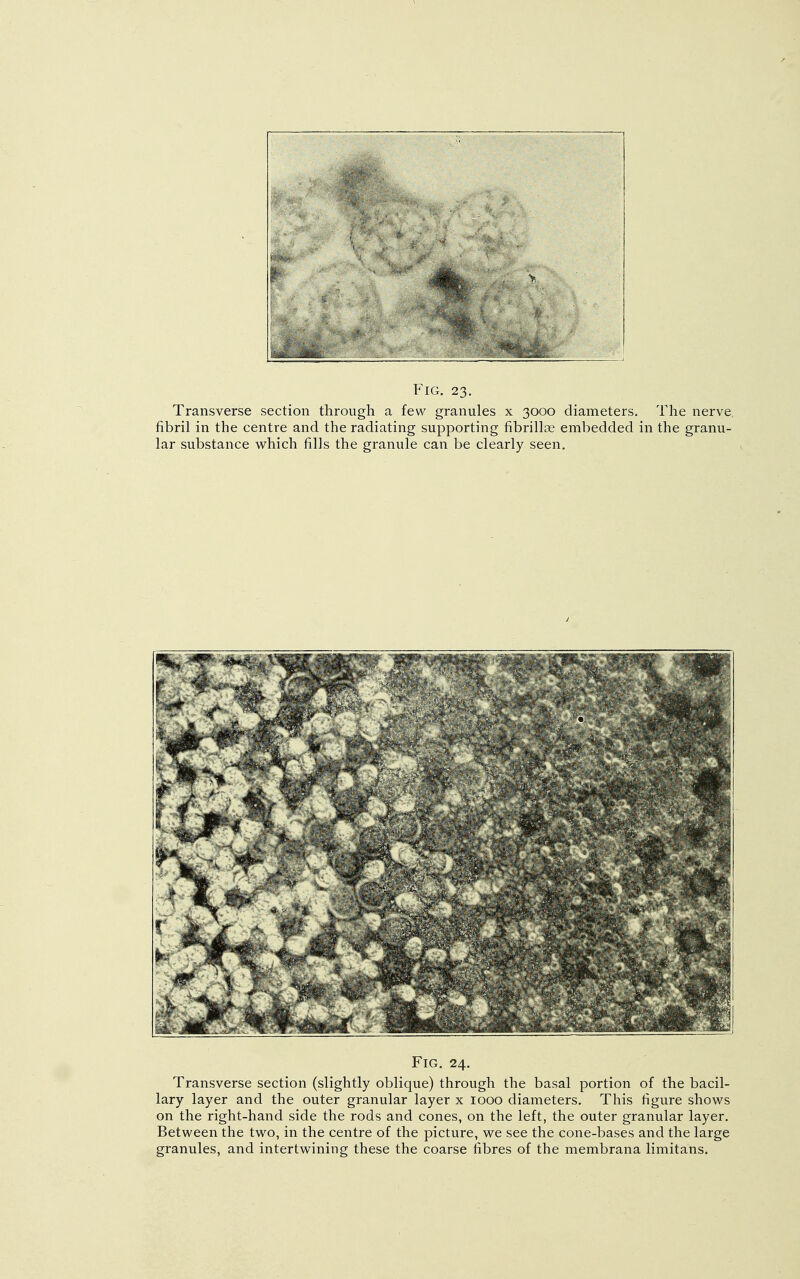 Transverse section through a few granules x 3000 diameters. The nerve fibril in the centre and the radiating supporting fibrillae embedded in the granu- lar substance which fills the granule can be clearly seen. Fig. 24. Transverse section (slightly oblique) through the basal portion of the bacil- lary layer and the outer granular layer x 1000 diameters. This figure shows on the right-hand side the rods and cones, on the left, the outer granular layer. Between the two, in the centre of the picture, we see the cone-bases and the large granules, and intertwining these the coarse fibres of the membrana limitans.