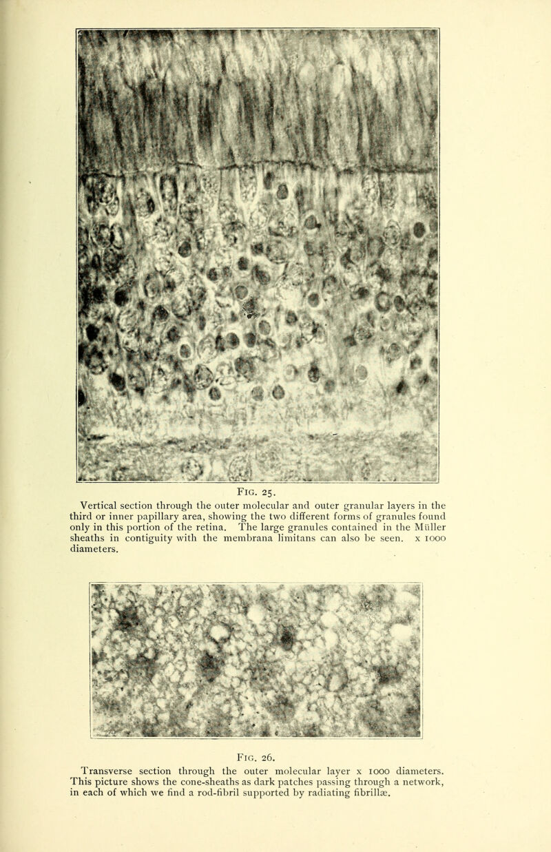 Fig. 25. Vertical section through the outer molecular and outer granular layers in the third or inner papillary area, showing the two different forms of granules found only in this portion of the retina. The large granules contained in the Midler sheaths in contiguity with the membrana limitans can also be seen, x 1000 diameters. Fig. 26. Transverse section through the outer molecular layer x 1000 diameters. This picture shows the cone-sheaths as dark patches passing through a network, in each of which we find a rod-fibril supported by radiating nbrillae.