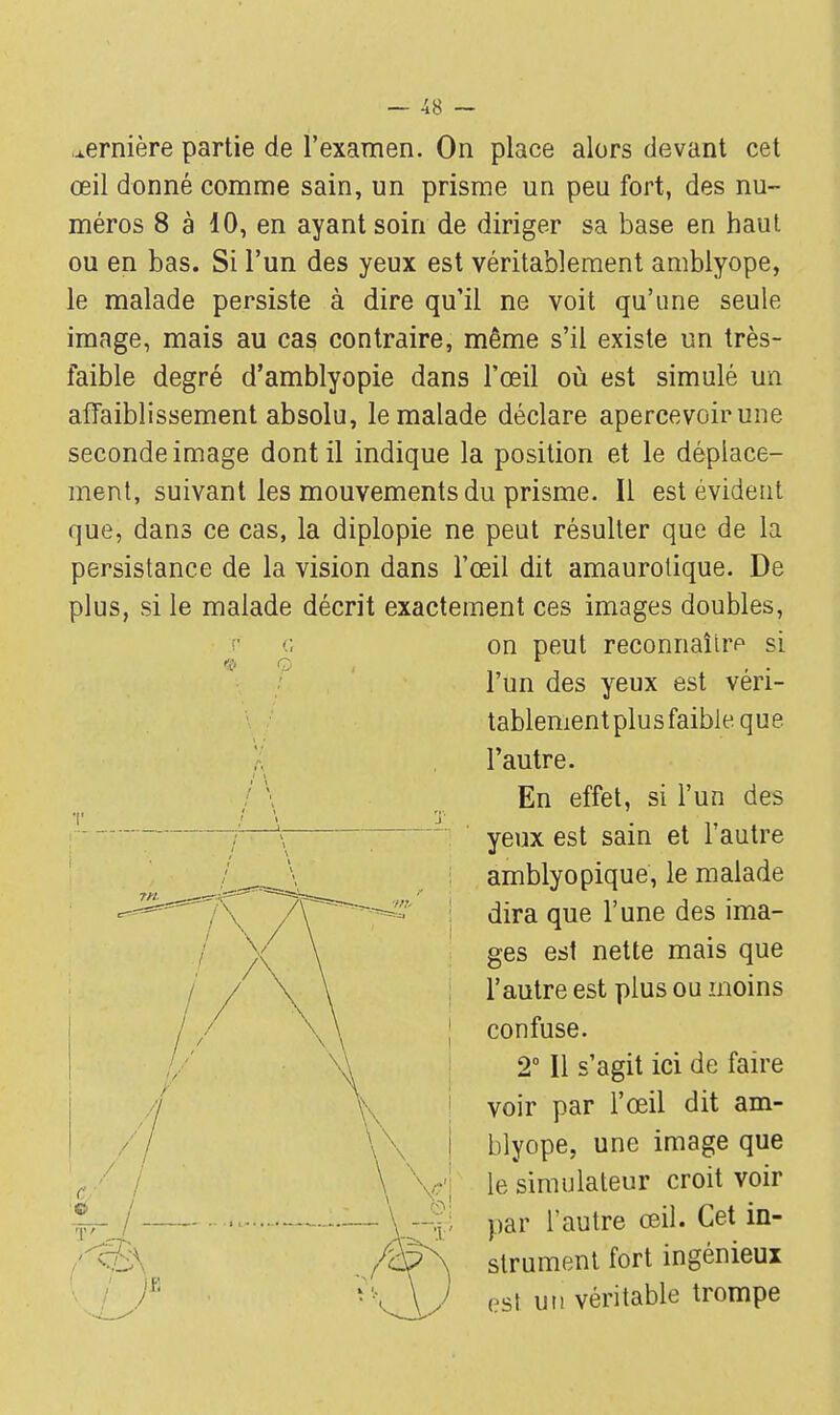 ornière partie de l'examen. On place alors devant cet œil donné comme sain, un prisme un peu fort, des nu- méros 8 à 10, en ayant soin de diriger sa base en haut ou en bas. Si l'un des yeux est véritablement amblyope, le malade persiste à dire qu'il ne voit qu'une seule image, mais au cas contraire, même s'il existe un très- faible degré d'amblyopie dans l'œil où est simulé un affaiblissement absolu, le malade déclare apercevoir une seconde image dont il indique la position et le déplace- ment, suivant les mouvements du prisme. Il est évident que, dans ce cas, la diplopie ne peut résulter que de la persistance de la vision dans l'œil dit amaurotique. De plus, si le malade décrit exactement ces images doubles, c on peut reconnaîirp si l'un des yeux est véri- tablement plus faible, que l'autre. En effet, si l'un des [ yeux est sain et l'autre amblyopique, le malade ?r^~~«  dira que l'une des ima- \ ges est nette mais que v \ l'autre est plus ou moins \ \ | confuse. 2° Il s'agit ici de faire voir par l'œil dit am- \\ | blyope, une image que \ y; le simulateur croit voir - \ -~ ; par l'autre œil. Cet in- strument fort ingénieux •\ \J est ui! véritable trompe