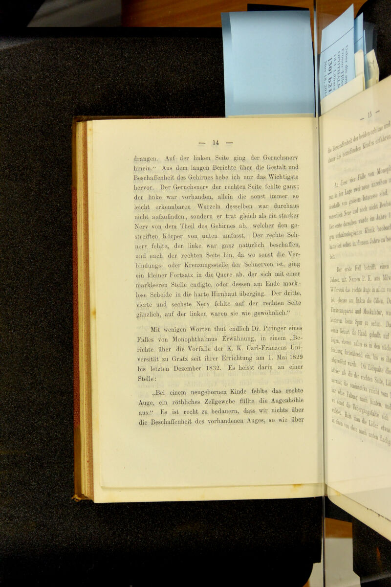 I 4 drangen. Auf der linken Seite ging der Geruchsnerv hinein. Aus dem langen Berichte über die Gestalt und Beschaffenheit des Gehirnes hebe ich nur das Wichtigste hervor. Der Geruchsnerv der rechten Seite fehlte ganz; der linke war vorhanden, allein die sonst immer so leicht erkennbaren Wurzeln desselben war durchaus nicht aufzufinden, sondern er trat gleich als ein starker Nerv von dem Theil des Gehirnes ab, welcher den ge- streiften Körper von unten umfasst. Der rechte Seh- nerv feilte, der hnke war ganz natürlich beschaffen, und nach der recliten Seite hin, da wo sonst die Ver- bindungs- oder Kreuzungsstelle der Sehnerven ist, ging ein kleaier Fortsatz in die Quere ab. der sich mit einer markleereu Stelle endigte, oder dessen am Ende mark- lose Scheide in die harte Hirnhaut überging. Der dritte, vierte und sechste Nerv fehlte auf der rechten Seite gänzlich, auf der linken waren sie wie gewöhnhch. Mit wenigen Worten thut endlich Dr. Piringer eines Falles von Monophthalmus Erwähnung, in einem „Be- richte über die Vorfälle der K. K. Carl-Franzens Uni- versität zu Gratz seit ihrer Errichtung am 1. Mai 1829 bis letzten Dezember 1832. Es heisst darin an einer Stelle: „Bei einem neugebornen Kinde fehlte das rechte Auge, ein röthHches ZeUgewebe füllte die Augenhöhle aus. Es ist recht zu bedauern, dass wir mchts über die Beschaffenheit des vorhandenen Auges, so wie über