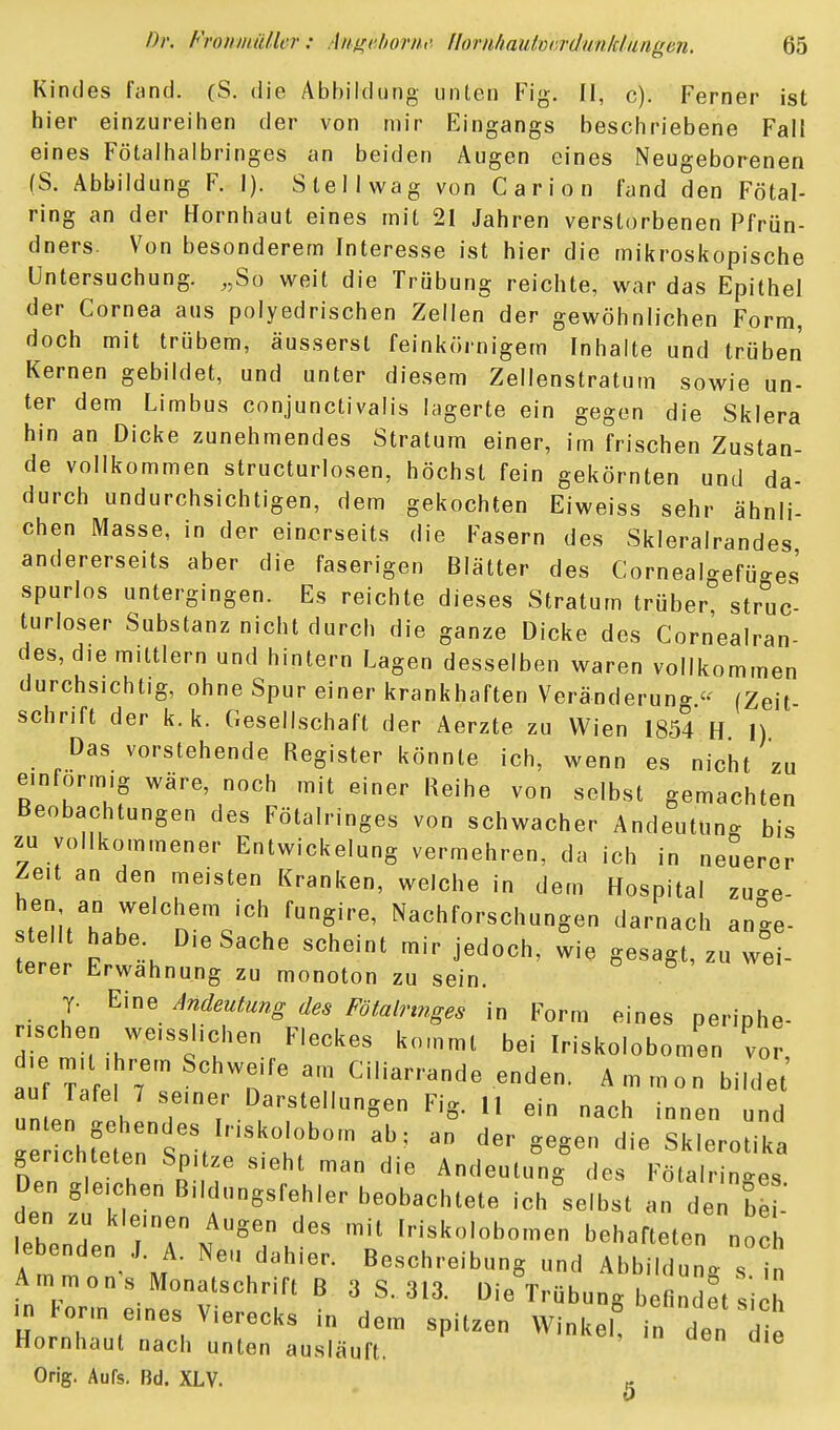 Kindes fand. (S. die Abbildung unten Fig. II, c). Ferner ist hier einzureihen der von mir Eingangs beschriebene Fall eines Fötalhalbringes an beiden Augen eines Neugeborenen (S. Abbildung F. I). Stell wag von Carion fand den Fötal- ring an der Hornhaut eines mit 21 Jahren verstorbenen Pfrün- dners. Von besonderem Interesse ist hier die mikroskopische Untersuchung. ,,Sü weit die Trübung reichte, war das Epithel der Cornea aus poiyedrischen Zellen der gewöhnlichen Form, doch mit trübem, äusserst feinkörnigem Inhalte und trüben Kernen gebildet, und unter diesem Zellenstratum sowie un- ter dem Limbus conjunctivalis lagerte ein gegen die Sklera hin an Dicke zunehmendes Stratum einer, im frischen Zustan- de vollkommen structurlosen, höchst fein gekörnten und da- durch undurchsichtigen, dem gekochten Eiweiss sehr ähnli- chen Masse, in der einerseits die Fasern des Skleralrandes andererseits aber die faserigen Blätter des Cornealgefüges spurlos untergingen. Es reichte dieses Stratum trüber struc- turloser Substanz nicht durch die ganze Dicke des Cornealran- des, die mittlem und hintern Lagen desselben waren vollkommen durchsichtig, ohne Spur einer krankhaften Veränderung (Zeit Schrift der k. k. Gesellschaft der Aerzte zu Wien 1854 H 1) Das vorstehende Register könnte ich, wenn es nicht zu einförmig wäre, noch mit einer Reihe von selbst gemachten Beobachtungen des Fötalringes von schwacher Andeutung bis zu vollkommener Entwicklung vermehren, da ich in neuerer Zeit an den meisten Kranken, welche in dem Hospital zuo-e- hen an welchem ich fungire, Nachforschungen darnach ange- t It habe Die Sache scheint mir jedoch, wie gesagt, zu wei- terer Erwähnung zu monoton zu sein. y. Eine Andeutung des Fötalrmges in Form eines periphe- nschen weisslichen Fleckes kommt bei Iriskolobomen vor, d e n.,t . rem Schweife am Ciliarrande enden. Ammon bilde unLI H Darstellungen Fig. M ein nach innen und oenchteten Spitze sieht man die Andeutung des Fötalringes Den gleichen B.ldungsfehler beobachtete ich selbst an den be ' den zu kleinen Augen des mit Iriskolobomen behafteten nocL lebenden I. A. Neu dahier. Beschreibung und Abbildung s i^ Ammons Monatschrift B 3 S. 313. Die Trübung befindet sich in Form eines Vierecks in dem spitzen Winkel^ in den die Hornhaut nach unten ausläuft. Orig. Aufs. Bd. XLV. k