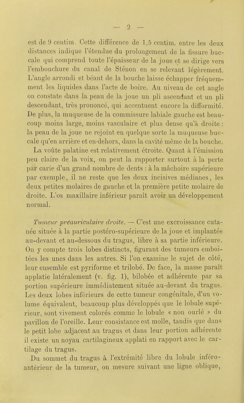 est de 9 ceutim. Cette différence de 1,5 ceiitim, entre les deux distances indique l'étendue du prolongement de la fissure buc- cale qui comprend toute l'épaisseur de la joue et se dirige vers l'embouchure du canal de Sténon en se relevant légèrement. L'angle arrondi et béant de la bouche laisse échapper fréquem- ment les liquides dans l'acte de boire. Au niveau de cet angle on constate dans la peau de la joue un pli ascendant et un pli descendant, très prononcé, qui accentuent encore la difformité. De plus, la muqueuse de la commissure labiale gauche est beau- coup moins large, moins vasculaire et plus dense qu'à droite : la peau de la joue ne rejoint en quelque sorte la muqueuse buc- cale qu'en arrière et en-dehors, dans la cavité même de la bouche. La voûte palatine est relativement étroite. Quant à l'émission peu claire de la voix, on peut la rapporter surtout à la perte par carie d'un grand nombre de dents : à la mâchoire supérieure par exemple, il ne reste que les deux incisives médianes, les deux petites molaires de gauche et la première petite molaire de droite. L'os maxillaire inférieur paraît avoir un développement normal. Tumeur préauriculaire droite. — C'est une excroissance cuta- née située à la partie postoro-supérieure de la joue et implantée au-devant et au-dessous du tragus, libre à sa partie inférieure. On y compte trois lobes distincts, figurant des tumeurs emboi- tées les unes dans les autres. Si l'on examine le sujet de côté, leur ensemble est pyriforme et trilobé. De face, la masse parait applatie latéralement (v. fig. 1), bilobée et adhérente par sa portion supérieure immédiatement située au-devant du tragus. Les deux lobes inféi-ieurs de cette tumeur congénitale, d'un vo- lume équivalent, beaucoup plus développés que le lobule supé- rieur, sont vivement colorés comme le lobule « non ourlé » du pavillon de l'oreille. Leur consistance est molle, tandis que dans le petit lobe adjacent au tragus et dans leur portion adhérente il existe un noyau cartilagineux applati en rapport avec le car- tilage du tragus. Du sommet du tragus à l'extrémité libre du lobule inféro- antérieur de la tumeur, on mesure suivant une ligne oblique,