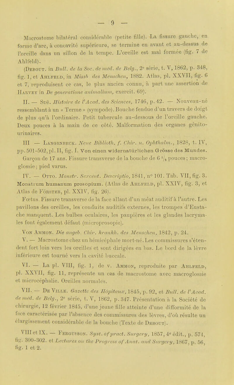 Macrostome bilatéral oonsidéralilo (petite fille). La fissure gauche, en l'orme d'arc, à concavité supérieure, se termine en avant et au-dessus de l'oreille dans un sillon de la tempe. L'oreille est mal formée (fig. 7 de Ahlfeld). (Debout, in Bull. de. la Soc. de méd. de Belg., 2'' série, t. V, 1862, p. 348, fig. 1, et Ahlfeld, in Missh des Menschen, 1882. Atlas, pl. XXVII, fig. 6 et 7, repi-oduiseut ce cas, le plus ancien connu, à part une assertion de IIakvey in De generatione animalhim, exercit. 69). II. — Suë. Histoire de VAcad. des Sciences, 1746, p. 42. — Nouveau-né ressemblant à un « Terme » (sympode). Bouche fendue d'un travers de doigt de plus qu'à l'ordinaire. Petit tubercule au-dessous de l'oreille gauche. Deux pouces à la main de ce côté. Malformation des organes génito- urinaires. III — Langenbeck. Ncue Biblioth. f. Chir. u. Ophthahn., 1828, t. IV, pp. 501-502,pl. Il, fig. I. Von einen widernatûrlichen Grosse des Mundes. Garçon de 17 ans. Fissure transverse de la bouche de 6 '/j pouces ; macro- glossie; pied varus. IV. — Otto. Monstr. Sercent. Bescriptio, 1841, n» 101. Tab. VII, fig. 3. Monstrum humanum prosopium. (Atlas de Ahlfeld, pl. XXIV, fig. 3, et Atlas de Fôkster, pl. XXIV, fig. 26). Fœtus. Fissure transverse de la face allant d'un méat auditif à l'autre. Les l^avillons des oreilles, les conduits auditifs externes, les trompes d'Eusta-- che manquent. Les bulbes oculaires, les paupières et les glandes lacryma- les font également défaut (microprosopie). Von Ammon. Die angeb. Chir. hrankh. des Menschen, 1842, p. 24. V. — Macrostome chez un hémicéphale mort-né. Les commissures s'éten- dent fort loin vers les oreilles et sont dirigées en bas. Le bord de la lèvre inférieure est tourné vers la cavité buccale. VI. — La pl. VIII, fig. 1, de v. Ammon, reproduite par Ahlfeld, pl. XXVII, fig. 11, représente un cas de macrostome avec macroglossie et microcéphalie. Oreilles normales. VII. — De Ville. Gazette des Hôpitaux, 1845, p. 92, et Bull, de VAcad. de méd. de Belg., 2 série, t. V, 1862, p. 347. Présentation à la Société de chirurgie, 12 février 1845, d'une jeune fille atteinte d'une dilTormité de la f;ice caractérisée par l'absence des commissures des lèvres, d'où résulte un élargissement considérable de la bouche (Texte de Debout). VIII et IX. — Fehgusson. Syst. ofpract. Snrgcry, 1867, 4« édit., p. 574, fig. 300-302. et Lectures on ihc Progress ofAnat. and Surgery, 1867, p. 56