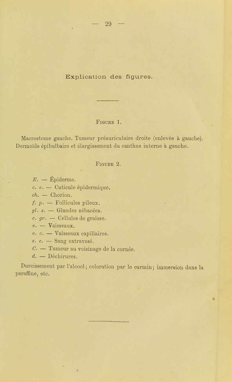 — 29 — Explication des figures. FiSUBE 1. Macrostome gauche. Tumeur préauriculaire droite (enlevée à gauche). Dermoïde épibulbaire et élargissement du canthus interne à gauche. FiGUEE 2. E. — Épiderme. ce. — Cuticule épidermique. ch. — Chorion. f. p. — Follicules pileux. gl. s. — Glandes sébacées. c. gr. — Cellules de graisse. V. — Vaisseaux. V. c. — Vaisseaux capillaires. s. e. — Sang extravasé. C. — Tumeur au voisinage de la cornée. d. — Déchirures. Durcissement par l'alcool ; coloration par le carmin ; immersion dans la paraffine, etc. «