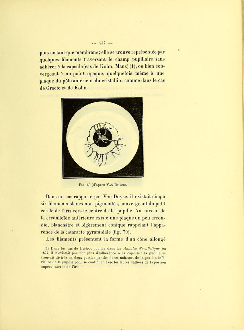 - .i;!T — plus en tant que membrane ; elle se ti-ouve représentée par quelques filaments traversant le champ pupillaire sans adhérer à la capsule (cas de Kohn, Manz) (1), ou bien con- vergeant à un point opaque, quelquefois même à une plaque du pôle antérieur du cristallin, comme dans le cas de Graefe et de Kohn. FiG. 69 (d'après Van Duyse). Dans un cas rapporté par Van Duyse, il existait cinq à six filaments blancs non pigmentés, convergeant du petit cercle de l'iris vers le centre de la pupille. Au niveau de la cristalloïde antérieure existe une plaque un peu arron- die, blanchâtre et légèrement conique rappelant l'appa- rence de la cataracte pyramidale (fig. 70). Les filaments présentent la forme d'un cône allongé (1) Dans les cas de Brière, publiés dans les Annales d'oculistique eu 1874, il n'existait pas non plus d'adhérence à la capsule : la pupille se trouvait divisée en deux parties par des fibres naissant de la portion infé- rieure de la pupille pour se continuer avec les fibres radiées de la portion supéro-interne de l'iris.