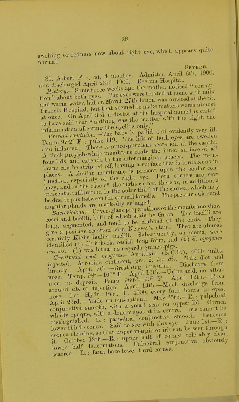 swelling or redness bow about right eye, wMcb appears quite normal. Seveee. ■^1 Alhert F- eet 4 months. Admitted April 6th, 1900, 31 A belt if 1900. Evelina Hospital. and discharged M^^f^^^f^J^^^^^^ the mother noticed  corrup- mstory.-Bomo thxee ^^^/-^^^^^^^ ^..^.^^^ home with milk tion about ^«th eyes^ moy-we ^^^^ ordered at the St. and to nuxke matters worse almost Erancs Hospital, ^ f ^-^^^'X'at the hospital named is slated inflammation affecting the e^^^^^^^^ on^^ ^^^^ ^ ^ iU. Present conM^^^^ ^|^^ ^,th eyes are swollen ^Tl'-fl 1.1 Thet is muco-purulent secretion at the caiith • and inflamed, iheie is ^^^^^y 1 , • ^ surface of all A thick greyish-wb. e ^^^-^/f^Z'^inal Spaces. The mem- four lids, ana extends ^^^^f/'^^.^^'^^ff^^ee that is lardaceous in brane can be stripped off, leaving ^ .^J^^^'J'^^ ^^^^ con- places. A simdar memW ^^^^^ cornea, are very j^auctiva, especui ly oyhe^u^^^^^^^ y ^^^^ .^^ ^ Wzy, and the c^^^^ of the 11 ^^.^^ ^^^.^^^^ ^^^^^ ^ cresceutic iiifiltiation m me u ,, pve-auricular and be due to pus between the cornea ameUee. iue i anc^ular glands are markedly e^'^^pj/^ j ^he membrane show 5cicfer/oZog2/.-Cover.glass prepa ations ot^^^^ . cocci and bacilli both of f^^^^d at the ends. They long, segmented, ^^l^.^'^^uh Nei«««^^^ give a positive reaction with JNeissei s ^ ^^^^.^ liS^?) 'wUi, a^d (2) S.,yo,e.es i^^^l^^^r^tS'l^^^^ ^000 units. Treatment and J^^-^S'^^^'T^f o fer die Milk diet and injected, f rop.ne ou.Unent gi..^^^^ ^.^^^^^ brandy. ^l-^^„o^^^:^o i* l^^^U lOth.-XJrine acid, no albu- nose. Temp. 98°-100 ^-^^o^aa^^^ April 12th.-Kash men, no deposit. _ Temp. Jo o • ^ discharge from around site of injection. M^^'J l'*'^^^^. f^ur hours to eyes nose. Lot. Hydr. Per., 1 . 40UU, ^J^J gSth.-R.: palpebral April 23rd.-Made an ont-patien . J^f'y f ^a. Cornea conjunctiva smooth, with a ^^^^ ^'^J^ j,;, cannot be wholly opaque, with ^^^^^:'^oo^. Leucoma distinguished. L. . P^^lfJ^::!!, this eye. June 1st.—R. : lower third cornea, baid to see ^his can be seen through cornea clearing, so that PP^^-^J^^j^^f.^ ^^.ea tolerably clear, it. October 12th.-E.: -PP^^^ ^^^^^.^^^ conjunctiva obviously Inwpr half leucomatous. Jr'alpeDiai j Bcln-ed L.: faint haze lower third cornea.