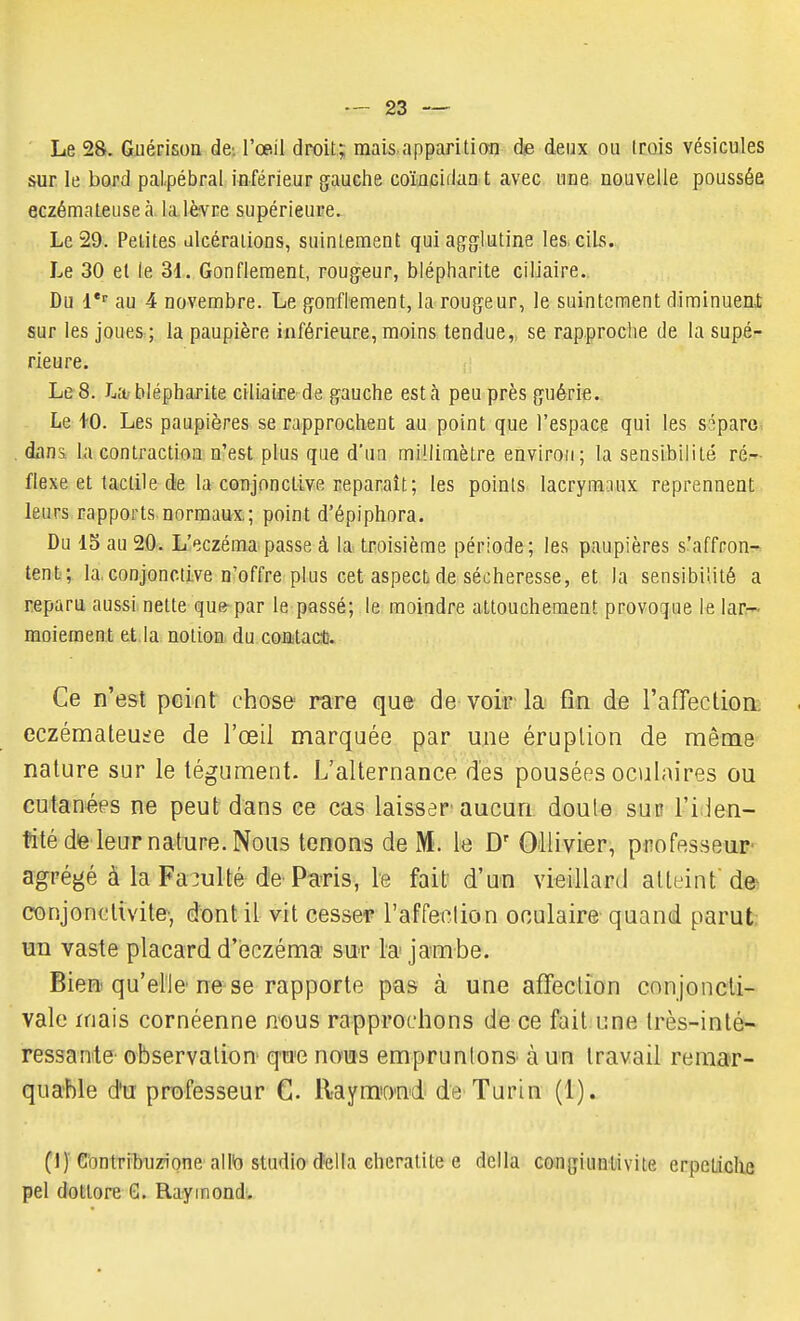 Le 28. Guérisoa de. l'œil droit; mais apparition de deux ou trois vésicules sur le bord palpébral inférieur gauche coMeidiia t avec «ne nouvelle poussée eczémateuse à la lèvre supérieure. Le 29. Petites alcérations, suintement qui ag-glutine les. cils. Le 30 et le 31. Gonflement, rougeur, blépharite ciliaire. Du au 4 novembre. Le gonflement, la rougeur, le suintement diminuenJ; sur les joues ; la paupière inférieure, moins tendue,, se rapproche de la supé- rieure. heS. Jjîtblépharite ciliaijie de gauche esta peu près guéri*. Le 10. Les paupières se rapprochent au point que l'espace qui les sépare^ dans, la contraction n'est plus que d'un millimètre environ; la sensibilité ré- flexe et tactile de la conjonctive reparaît; les points lacrymaux reprennent leurs rapports.normaux; point d'épiphora. Du IS au 20. L'eczéma passe à la troisième période; les paupières s'affron-^ tent; la,conjonctive n'offre plus cet aspect,de sécheresse, et la sensibilité a reparu aussi nette que-par le passé; le moindre attouchement provoque le lar:- moiement et la notion du contact. Ce n'est peint chose rare que de voir la fin de l'afTection^ eczémateuse de l'œil marquée par ujae éruption de même nature sur le tégument. L'alternance des pousées oculaires ou cutanées ne peut dans ee cas laisser aucun doute suit l'iiJen- tité deleurnature.Nous tenons de M. le D' OUivier, professeur agrégé à la Faculté de Paris, le fait d'un vieillard atteint dei conjonctivite-, dont il vit cesser l'affei^lion oculaire quand parut: un vaste placard d'eczéma sur la jambe. Bien qu'elle ne se rapporte pas à une affection conjoncli- vale mais cornéenne nous rapprochons de ce fait une très-inté- ressante- observation qm nous empruntons à un travail remar- quable d'u professeur G. llaym'and de Turin (1)» (!)■ C'ontribuzione allb studio delta cheratite e della congiuntivite erpeLiclie pel dotlore G. Raymond.