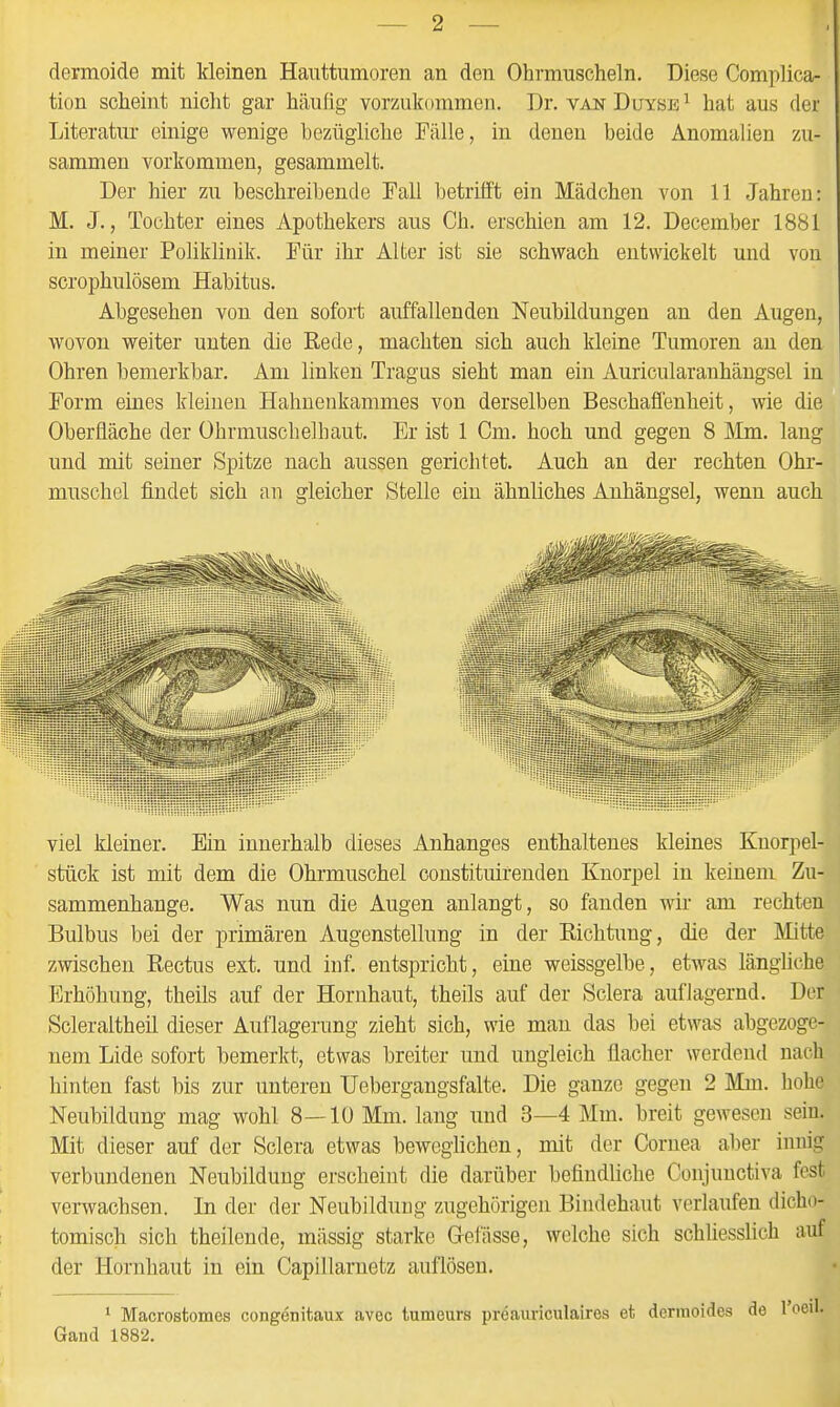 dernioide mit Meinen Hauttumoren an den Ohrmuscheln. Diese Complica- tion scheint nicht gar häufig vorzukommen. Dr. vanDuyöe^ hat aus der Literatur einige wenige bezügliche Fälle, in denen beide Anomalien zu- sammen vorkommen, gesammelt. Der hier zu beschreibende Fall betrifft ein Mädchen von 11 Jahren: M. J., Tochter eines Apothekers aus Ch. erschien am 12. December 1881 in meiner Poliklinik. Für ihr Alter ist sie schwach entwickelt und von scrophulösem Habitus. Abgesehen von den sofort auffallenden Neubildungen an den Augen, wovon weiter unten die Rede, machten sich auch kleine Tumoren au den Ohren bemerkbar. Am linken Tragus sieht man ein Auricularanhängsel in Form eines kleinen Hahuenkanimes von derselben Beschaffenheit, wie die Oberfläche der Ohrmuschelhaut. Er ist 1 Cm. hoch und gegen 8 Älm. lang und mit seiner Spitze nach aussen gerichtet. Auch an der rechten Ohr- muschel findet sich an gleicher Stelle ein ähnliches Anhängsel, wenn auch viel kleiner. Ein innerhalb dieses Anhanges enthaltenes kleines Knorpel- i stück ist mit dem die Ohrmuschel constituirenden Knorpel in keinem Zu- I sammenhange. Was nun die Augen anlangt, so fanden wir am rechten 1 Bulbus bei der primären Augenstellung in der Eichtung, die der Mitte ' zwischen Eectus ext. und inf. entspricht, eine weissgelbe, etwas längliche ^ Erhöhung, theils auf der Hornhaut, theils auf der Sclera auflagernd. Der ; Scleraltheil dieser Auflagerung zieht sich, wie man das bei etwas abgezoge- j nem Lide sofort bemerkt, etwas breiter und ungleich flacher werdend nach '. hinten fast bis zur unteren Uebergangsfalte. Die ganze gegen 2 Mm. hohe Neubildung mag wohl 8—10 Mm. lang und 3—4 Mm. breit gewesen sein. Mit dieser auf der Sclera etwas beweglichen, mit der Cornea aber innig ] verbundenen Neubildung erscheint die darüber befindliche Conjunctiva fest ' verwachsen. In der der Neubildung zugehörigen Bindehaut verlaufen dicho- ■ tomiscli sich theilende, mässig starke Gelasse, welche sich schüesslich auf I der Hornhaut in ein Capillarnetz auflösen. ' Macrostomes congenitaux avec tumeurs preauriculaires et derraoides de l'oeil. Gand 1882. l :