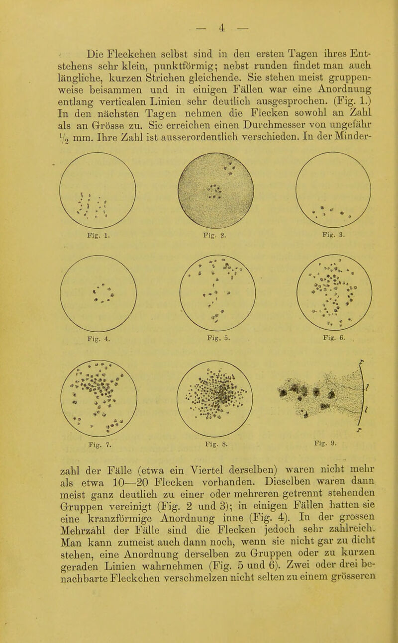 Die Fleckchen selbst sind in den ersten Tagen ihres Ent- stehens sehr klein, punktförmig; nebst runden findet man auch längliche, kurzen Strichen gleichende. Sie stehen meist gruppen- weise beisammen und in einigen Fällen war eine Anordnung entlang verticalen Linien sehr deutlich ausgesprochen. (Fig. 1.) In den nächsten Tagen nehmen die Flecken sowohl an Zahl als an Grösse zu. Sie erreichen einen Durchmesser von ungefähr 1 2 mm. Ihre Zahl ist ausserordentlich verschieden. In der Minder- Fig. 7. Fig. 8. Fig- »• zahl der Fälle (etwa ein Viertel derselben) waren nicht mehr als etwa 10—20 Flecken vorhanden. Dieselben waren dann meist ganz deutlich zu einer oder mehreren getrennt stehenden Gruppen vereinigt (Fig. 2 und 3); in einigen Fällen hatten sie eine kranzförmige Anordnung inne (Fig. 4). In der grossen Mehrzahl der Fälle sind die Flecken jedoch sehr zahlreich. Man kann zumeist auch dann noch, wenn sie nicht gar zu dicht stehen, eine Anordnung derselben zu Gruppen oder zu kurzen geraden Linien wahrnehmen (Fig. 5 und 6). Zwei oder drei be- nachbarte Fleckchen verschmelzen nicht selten zu einem grösseren