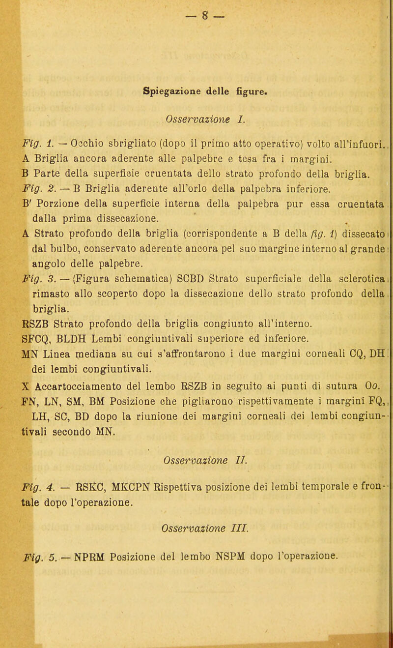 Spiegazione delle figure. Osservazione I. Fig. 1. — Occhio sbrigliato (dopo il primo atto operativo) volto all'infuori. A Briglia ancora aderente alle palpebre e tesa fra i margini. B Parte della superficie cruentata dello strato profondo della briglia. Fig. 2. — B Briglia aderente all'orlo della palpebra inferiore. B' Porzione della superficie interna della palpebra pur essa cruentata dalla prima dissecazione. A Strato profondo della briglia (corrispondente a B della fig. 1) dissecato dal bulbo, conservato aderente ancora pel suo margine interno al grande angolo delle palpebre. Fig. 3. — (Figura schematica) SCBD Strato superficiale della sclerotica rimasto allo scoperto dopo la dissecazione dello strato profondo della briglia. RSZB Strato profondo della briglia congiunto all'interno. SFCQ, BLDH Lembi congiuntivali superiore ed inferiore. MN Linea mediana su cui s'affrontarono i due margini corneali CQ, DH dei lembi congiuntivali. X Accartocciamento del lembo RSZB in seguito ai punti di sutura Oo. FN, LN, SM, BM Posizione che pigliarono rispettivamente i margini FQ, LH, SC, BD dopo la riunione dei margini corneali dei lembi congiun- tivali secondo MN. Osservazione II. Fig. 4. — RSKC, MKCPN Rispettiva posizione dei lembi temporale e fron- tale dopo l'operazione. Osservazione III. Fig. 5. — NPRM Posizione del lembo NSPM dopo l'operazioue.