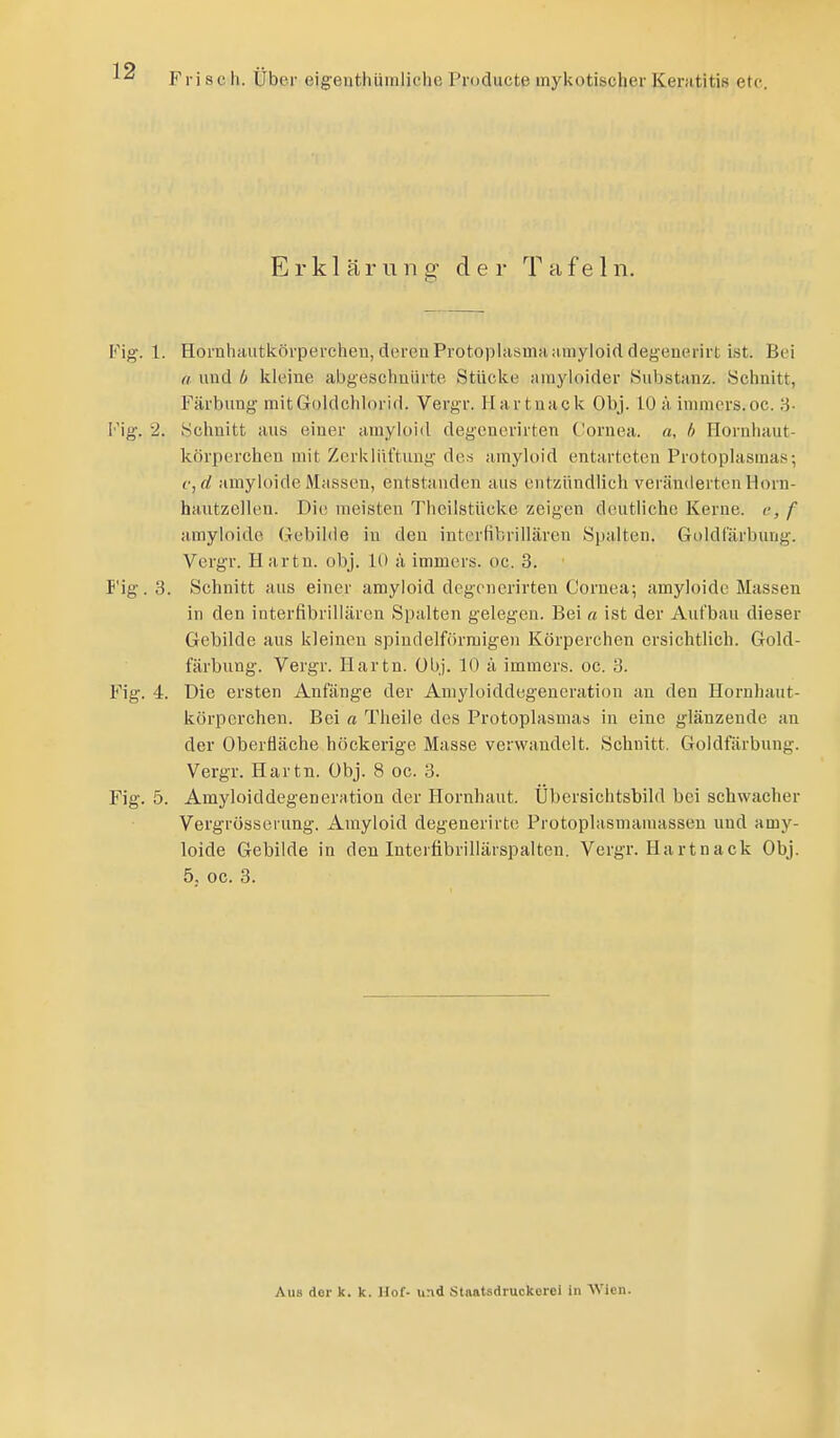 Erklärung der Tafeln. Fig. 1. Hornhaiitiiörperclieu, deren Protoplasma Jiuiyloid degenerirt ist. Bei a und b kleine abgeschnürte Stücke ainyloider Snbstanz. Schnitt, Färbung mit Goldchlorid. Vergr. Ilartnack Obj. 10 ä inmiers.oc. 3- Fig. 2. Schnitt aus einer amyloid degonerirten C!ornea. a, h Hornhaut- körperchen mit Zerklüftung des amyloid entarteten Protoplasma.«-, c,d amylüide Massen, entstanden aus entzündlich veränderten Horn- hautzellen. Die meisten Theilstücke zeigen deutliche Kerne, c, f amyloide Gebilde in den interfibrillären Spalten. Goldf'ärbung. Vergr. Hartn. obj. 10 a immers. oc. 3. I'ig.3. Schnitt aus einer amyloid degonerirten Cornea; amyloide Massen in den interfibrillären Spalten gelegen. Bei « ist der Aufbau dieser Gebilde aus kleinen spindelförmigen Körperchen ersichtlich. Gold- färbung. Vergr. Hartn. Obj. 10 ä immers. oc. 3. Fig. 4. Die ersten Anfänge der Amyloiddegeneration an den Hornhaut- körperchen. Bei a Theile des Protoplasmas in eine glänzende an der Oberfläche höckerige Masse verwandelt. Schnitt. Goldfärbung. Vergr. Hartn. Obj. 8 oc. 3. Fig. 5. Amyloiddegeneration der Hornhaut. Übersichtsbild bei schwacher Vergrösserung. Amyloid degenerirte Protoplasmamassen und amy- loide Gebilde in den Intertibrillärspalten. Vergr. Ha rtnack Obj. 5. oc. 3. AuB dor k. k. Hof- und Stnatsdruckerei in Wien.