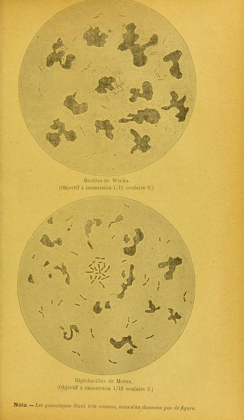 Bacilles de Wecks. (Objectif à immersion 1/12 oculaire 3.) Diplobacilles de Morax. (Objectif à immersion 1/12 oculaire 3.) gonocoques étant très connus, nous n'en donnons pas de figi,