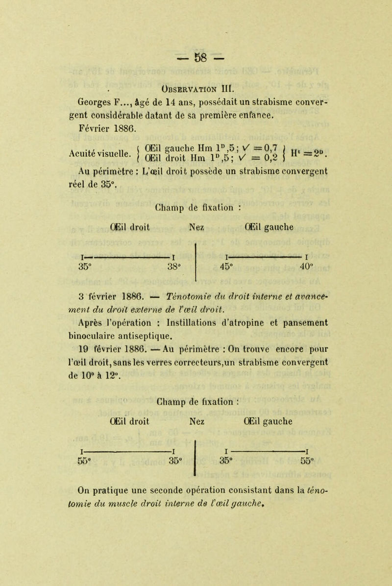 Observation III. Georges F..., âgé de 14 ans, possédait un strabisme conver- gent considérable datant de sa première enfance. Février 1886. Acuité visuelle. H« =2°. OEil gauche Hm 1D,5; V = 0,7 Œil droit Hm 1D,5; ✓ = 0,2 Au périmètre : L'œil droit possède un strabisme convergent réel de 35°. Champ de fixation : OEil droit Nez OEil gauche 35° -I 38° I— 45° 40° 3 février 1886. — Ténotomie du droit interne et avance- ment du droù externe de l'œil droit. Après l'opération : Instillations d'atropine et pansement binoculaire antiseptique. 19 février 1886.—Au périmètre : On trouve encore pour l'œil droit, sans les verres correcteurs,un strabisme convergent de 10° à 12°. Champ de fixation : OEil droit Nez OEil gauche 55° -i 35° i ■ 35° On pratique une seconde opération consistant dans la téno- tomie du muscle droit interne de l'œil gauche.