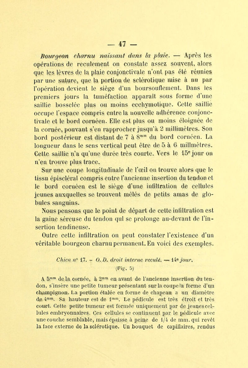 Bourgeon charnu naissant dans kt, plaie. — Après les opérations de reculement on constate assez souvent, alors que les lèvres de la plaie conjonctivale n'ont pas été réunies par une suture, que la portion de sclérotique mise à nu par l'opération devient le siège d'un boursouflement. Dans les premiers jours la tuméfaction apparaît sous forme d'une saillie bosselée plus ou moins ecchymotique. Cette saillie occupe l'espace compris entre la nouvelle adhérence conjonc- tivale et le bord cornéen. Elle est plus ou moins éloignée de la cornée, pouvant s'en rapprocher jusqu'à 2 millimètres. Son bord postérieur est distant de 7 à 8mm du bord cornéen. La longueur dans le sens vertical peut être de 5 à 6 millmètres. Cette saillie n'a qu'une durée très courte. Vers le 15e jour on n'en trouve plus trace. Sur une coupe longitudinale de l'œil on trouve alors que le tissu épiscléral compris entre l'ancienne insertion du tendon et le bord cornéen est le siège d'une infiltration de cellules jeunes auxquelles se trouvent mêlés de petits amas de glo- bules sanguins. Nous pensons que le point de départ de cette infiltration est la gaine séreuse du tendon qui se prolonge au-devant de l'in- sertion tendineuse. Outre cette infiltration on peut constater l'existence d'un véritable bourgeon charnu permanent. En voici des exemples. Chien n° 17. - O.D. droit interne reculé. — Hejour. (Fig. 5) A 5mm de la cornée, à 2mm en avant de l'ancienne insertion du ten- don, s'insère une petite tumeur présentant sur la coupe la forme d'un champignon. La portion étalée en forme de chapeau a un diamètre de 4mm. Sa hauteur est de lmm. Le pédicule est très étroit et très court. Cette petite tumeur est formée uniquement par de jeunes cel- lules embryonnaires. Ces cellules se continuent par le pédicule avec une couche semblable, mais épaisse à peine de 1/4 de mm. qui revêt la face externe de la sclérotique. Un bouquet de capillaires, rendus