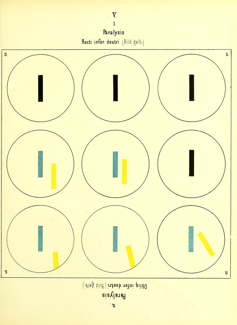 . Y. 1. ftpalysis Recti infer. dextri (^Bild ^elb.) Sis/'|BJBJ