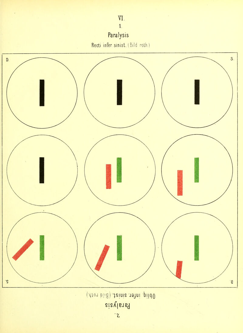 VI. 1. Paral)sis Recti infer sinist. l Bild roth ] (' 1 ) CO (V) J / ■ \ (/\) 0 (■q^oj p|ig)-'^siuis 'jajui bijqQ Sl§/C|BJBd
