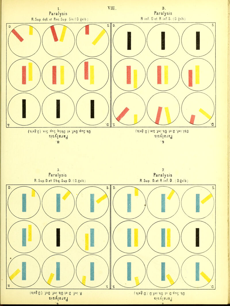 1, Paralysis R.Sup .de,fe et Rec.Sup. Sin.( D ^elb vm. 3. Paralysis R inf, D et R inf, (D §elb: 8 SISÄ| EJBj ■9 Paralysis R.Sup.D.et Obq.Sup D. ( D.^elb) Paralysis R.Sup. D.et R inf. 0. i D-^elbj