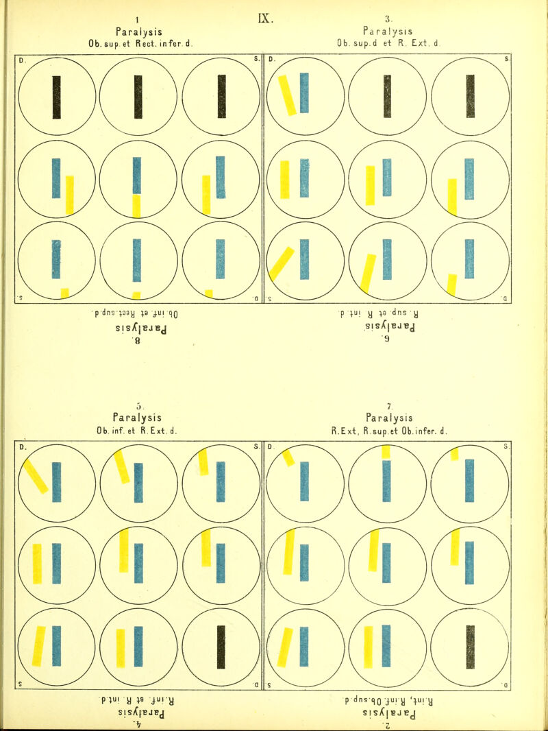 Paralysis Ob. sup.et Rect. infer. d. p■dns■:^^9y 5.3 j.ui qQ 8 Ob Pa ralysis sup.d et R. Ext. P ^ui y ^9 dns y 9 Faralysis Ob. inf. et R. Ext. d. Paralysis R.Ext, R.sup.et Ob.infer. d. SISX|EJEJ Z