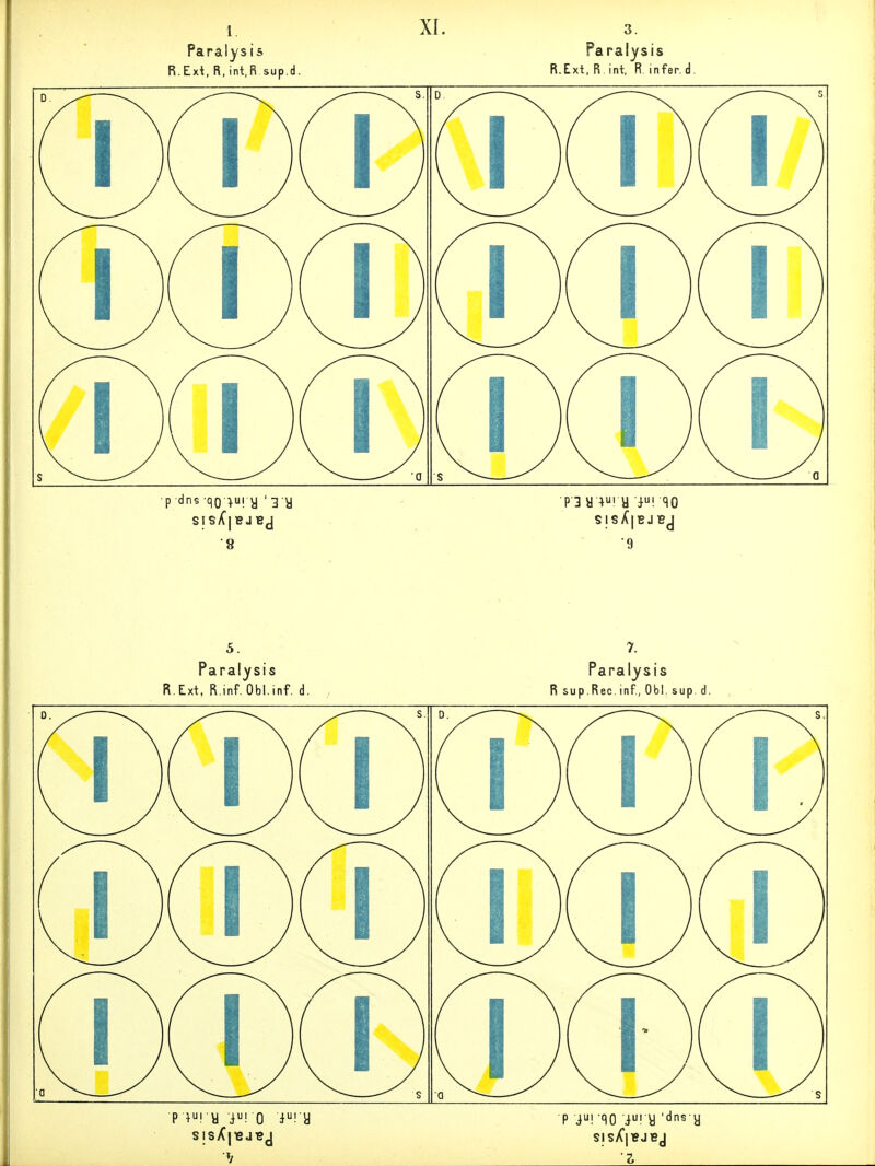 Paraiysis Paralysis R.Ext, R, int.R sup.d. R.Ext, R int, R. infer.d. ■p dns qo :fU! y ' 3 y . Pl« ;i y i! SO ■8 9 5. Paralysis R.Ext. R.inf. Obl.inf. d. SIsK|TßJBJ Paralysis R SUp.Ree. inf, Obl. sup. d. p i! qo i! y '<^ns y SIsX'lBJBJ
