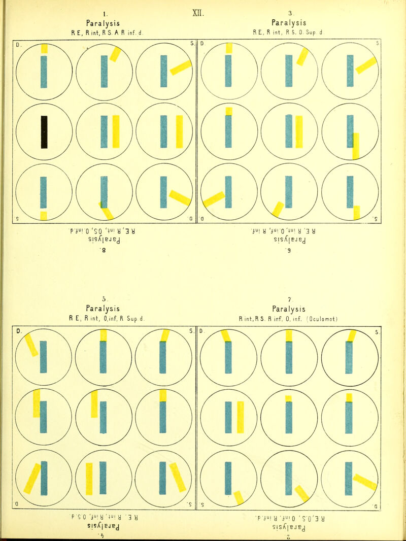 1. Paralysis R E, Rint. R S, A R inf. d. xir. p'i^^. Q 'SO y '3 y 9 Paralysis R E, R int, R S. 0. Sup d 9 R E 5. Paralysis R mt, O.inf, R Sup d. Paralysis R int,RS. R inf, 0, mf. fOculomot) ■p i! y 'i' 0 ' s o'3 y