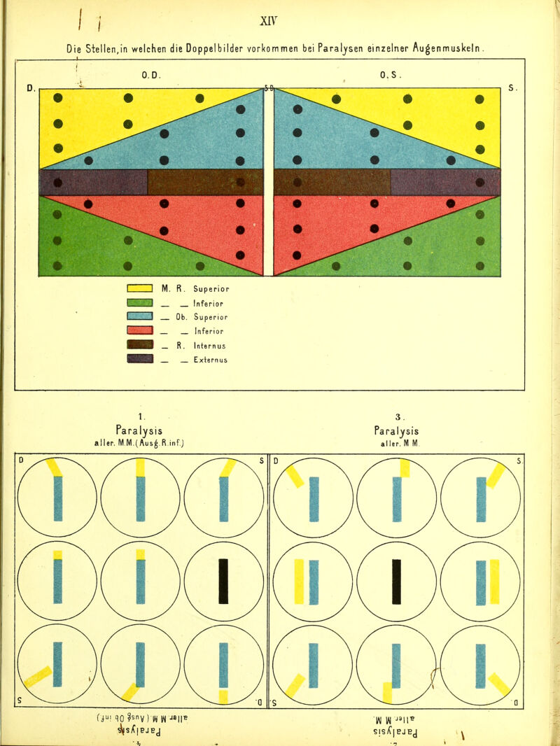 Die Stellen,in welchen die Doppelbilder vorkommen bei Paralysen einzelner Augenmuskeln O.D. I I M. R. Superior rr-, I Inferior I I Ob. Superior I— ■ I Inferior HHI — R. Internus IBHl Exiernus 0. s Paralysis aller, M M.(Aus^.R inf j Paralysis aller. 1« M.