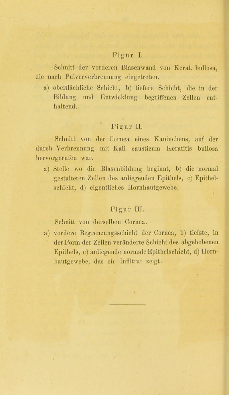 Figur I. Schnitt der vorderen Blasenwand von Kerat. bullosa, die nach Pulververbrennung eingetreten. a) oberflächliche Schicht, b) tiefere Schicht, die in der Bildung und Entwicklung begriffenen Zellen ent- haltend. Figur II. Schnitt von der Cornea eines Kaninchens, auf der durch Verbrennung mit Kali causticum Keratitis bullosa hervorgerufen war. a) Stelle wo die Blasenbildung beginnt, b) die normal gestalteten Zellen des anliegenden Epithels, c) Epithel- schicht, d) eigentliches Horuhautgewebe. Figur III. Schnitt von derselben Cornea, a) vordere Begrenzungsschicht der Cornea, b) tiefste, in der Form der Zellen veränderte Schicht des abgehobenen Epithels, c) anliegende normale Epithelschicht, d) Horn- hautgewebe, das ein Iniiltrat zeigt.