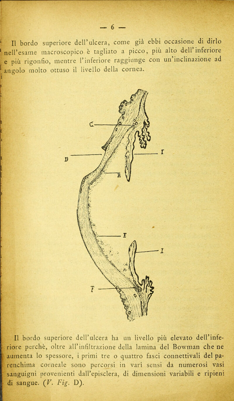 1 nell'esame macroscopico è tagliato a picco, più alto dell'inferiore e più rigonfio, mentre l'inferiore raggiunge con un'inclinazione ad 'angolo molto ottuso il livello della cornea, Ì D ■ Il bordo superiore dell'ulcera ha un livello più elevato dell'infe- riore perchè, oltre all'infiltrazione della lamina del Bowman che ne aumenta io spessore, i primi tre o quattro fasci connettivali del pa- renchima corneale sono percorsi in vari sensi da numerosi vasi sanguigni provenienti dall'episclera, di dimensioni variabili e ripieni di sangue. (V. Fig. D).