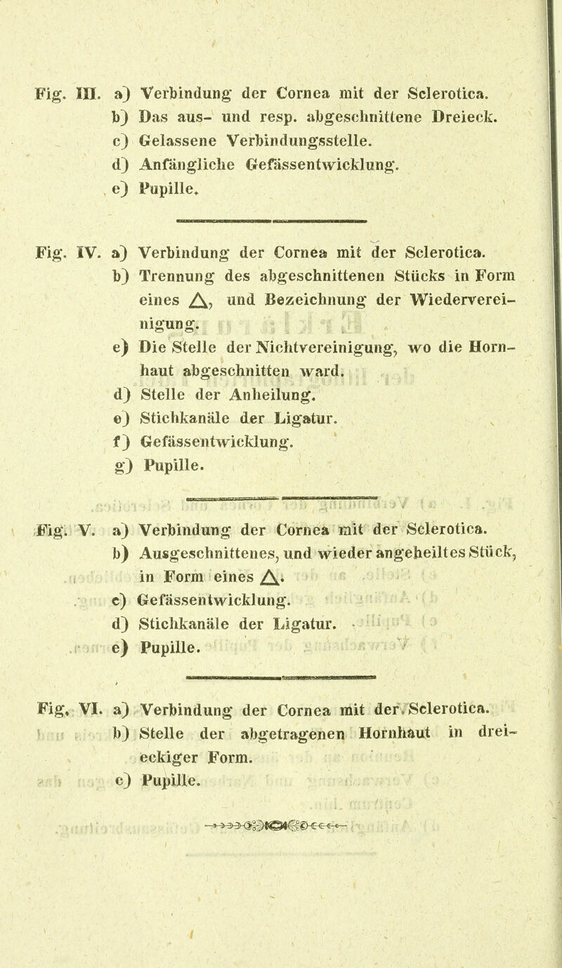 Fig. III. a) Verbindung* der Cornea mit der Sclerotica. b) Das aus- und resp. abgeschnittene Dreieck. c) Gelassene Verbindungsstelle. d) Anfängliche Gefässentwicklung. e) Pupille» Fig. IV. a) Verbindung der Cornea mit der Sclerotica. b) Trennung des abgeschnittenen Stücks in Form eines A? un(i Bezeichnung der Wiederverei- nigung, r |j Vj I ^| ;»| e) Die Stelle der NichtVereinigung, wo die Horn- haut abgeschnitten ward. d) Stelle der Anheilung. e) Stichkanäle der Ligatur. f) Gefässentwicklung. g) Pupille. Fig. V. a) Verbindung der Cornea mit der Sclerotica. b) Ausgeschnittenes, und wieder angeheiltes Stück, in Form eines c) Gefässentwicklung. d) Stichkanäle der Ligatur. e) Pupille. Fig, VI. a) Verbindung der Cornea mit der. Sclerotica. b) Stelle der abgetragenen Hornhaut in drei- eckiger Form. c) Pußille.