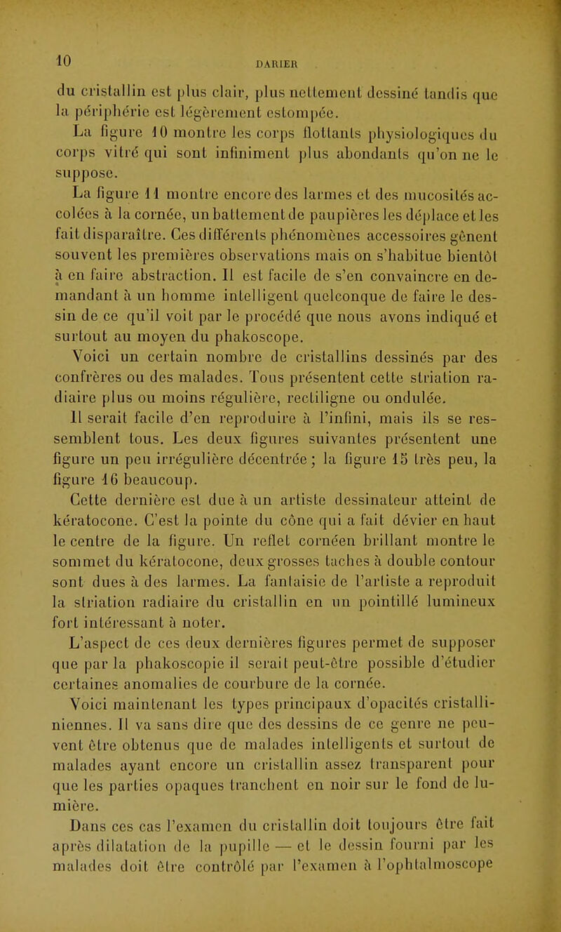du cristallin est plus clair, plus nettement dessiné tandis que la périphérie est légèrement estompée. La ligure 10 montre les corps flottants physiologiques du corps vitré qui sont infiniment plus ahondanls qu'on ne le suppose. La figure II montre encore des larmes et des mucosités ac- colées à la cornée, un battement de paupières les déplace et les fait disparaître. Ces difl'érenls phénomènes accessoires gênent souvent les premières observations mais on s'habitue bientôt à en faire abstraction. Il est facile de s'en convaincre en de- mandant à un homme intelligent quelconque de faire le des- sin de ce qu'il voit par le procédé que nous avons indiqué et surtout au moyen du phakoscope. Voici un certain nombre de cristallins dessinés par des confrères ou des malades. Tous présentent cette striation ra- diaire plus ou moins régulière, recliligne ou ondulée. 11 serait facile d'en reproduire à l'infini, mais ils se res- semblent tous. Les deux figures suivantes présentent une figure un peu irrégulière décentrée; la figure 15 très peu, la figure -16 beaucoup. Cette dernière est duc à un artiste dessinateur atteint de kératocone. C'est la pointe du cône qui a fait dévier en haut le centre de la figure. Un reflet cornéen brillant montre le sommet du kératocone, deux grosses taches à double contour sont dues à des larmes. La fanlaisie de l'artiste a reproduit la striation radiaire du cristallin en un pointillé lumineux fort intéressant à noter. L'aspect de ces deux dernières figures permet de supposer que par la phakoscopie il serait peut-être possible d'étudier certaines anomalies de courbure de la cornée. Voici maintenant les types principaux d'opacités cristalli- niennes. Il va sans dire que des dessins de ce genre ne peu- vent être obtenus que de malades intelligents et surtout de malades ayant encore un cristallin assez transparent pour que les parties opaques tranchent en noir sur le fond de lu- mière. Dans ces cas l'examen du cristallin doit toujours être fait après dilatatiou de la pupille — et le dessin fourni par les malades doit être contrôlé par l'examen h l'ophlalmoscope