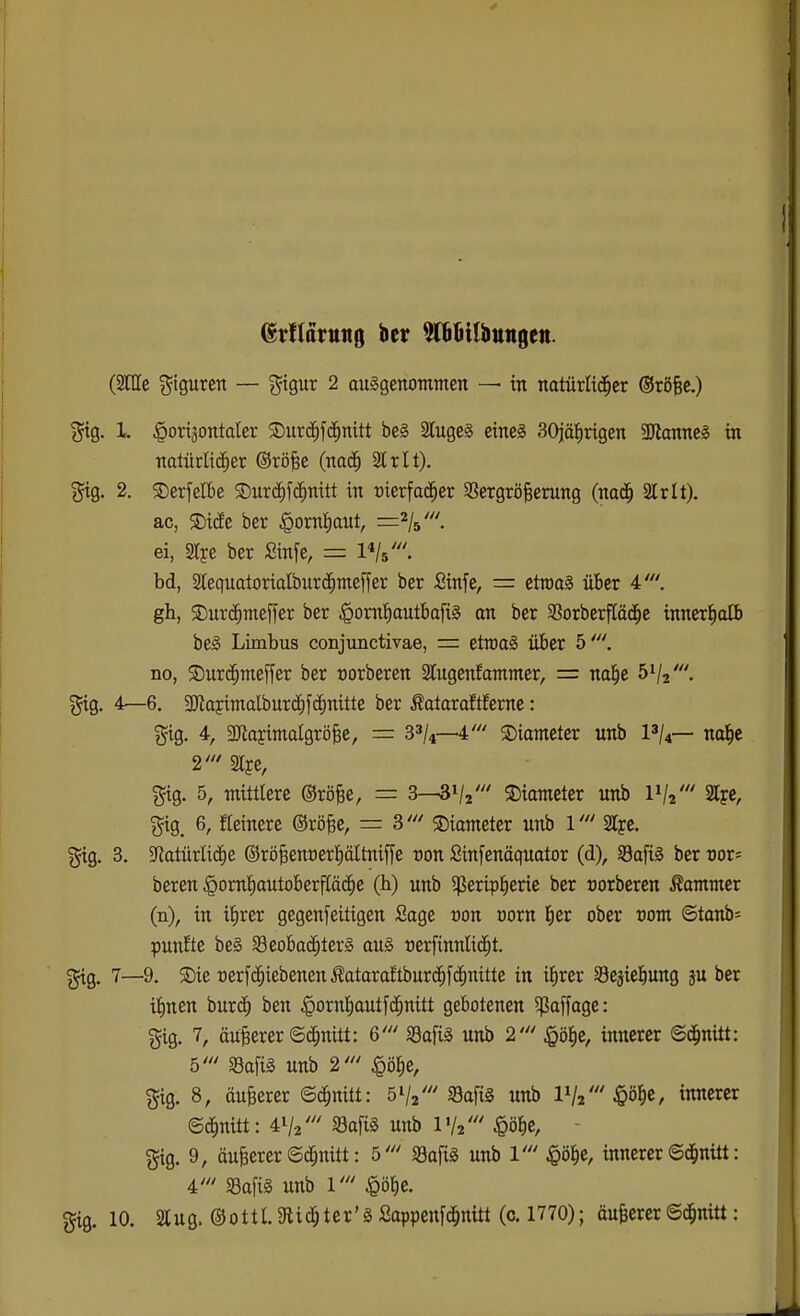 (SHIc gigurcn — gigur 2 ausgenommen — tn natürltd^er ©röBe.) 1. ^oxxpntakx ©urc^fd^nitt be§ 3luge§ eines SOjälfirigen SDlonneS in nalürlid^er ©rö^e (na^ Irlt). '^XQ. 2. 2)erfen)e 5Durö)f($nitt in t)ierfa(|er SSergrö^erung (na(| 2lrlt). ac, $Di(fe ber §ornf)aut, ei, 2Iye ber Sinfe, = l^/s'. bd, 2lequatorialbur(|meffer ber Sinfe, = etmaS über 4'. gh, 5Dur(^meffer ber ^omfiautbafiS an ber Sßorberfläd^e innerl^alb beS Limbus conjunctivae, = etroaS über 5'. no, S)urc§meffer ber uorberen Sfugenfammer, = nal^e 51/2'. gig. 4—6. aOfiapimalburc^fc^nitte ber Äaiaraftfeme: gig. 4, SJioyimalgrö^e, = 33/4—4' 5Diameter unb 1^/4— nal^e 2' Slye, gig. 5, mittlere ©rö^e, = S—B^lz' S)iameter unb 2l?e, gig, 6, fieinere ©röfee, = B' S)iameter unb l' Ije. ^g, 3. 3iZatürIi(i^e ©röBenuer^öItniffe von ßinfenäquator (d), SafiS ber vof bereu |>om!^autoberfläc^e (b) unb 5ßerip|erie ber oorbercn Cammer (n), in il^rer gegenfeitigen Sage von voxn E)er ober com ©tanb« punkte beS ^Beobachters aus »erfinnUc^t. gig. 7—9. 5Die t)erf(^iebenenÄataraftbur(^f(ihnitte in i^rer Sejiel^uitg ä ticr i:hnen burc^ ben |)ornIE)aut[chnitt gebotenen ^paffage: gig. 7, äußerer 6(§nitt: 6' SafiS unb 2' §ö^c, innerer ©d^nitt: 5' SBafiS unb 2' ^ö^e, gig. 8, äuBerer ©c^nitt: 51/2' 93afi§ unb IV2' §ö^Cr innerer ©c^nitt: 41/2' SafiS unb IV2' ^ö^c, - gig. 9, äußerer ©df;nitt: 5' SafiS unb V §ö|e, innerer ©d^nitt: 4' S3a[iS unb l' $ö^e. gig. 10. saug. ©ottlSRic^ter'SSappcnfc^nitt (c. 1770); äußerer©d^nitt: