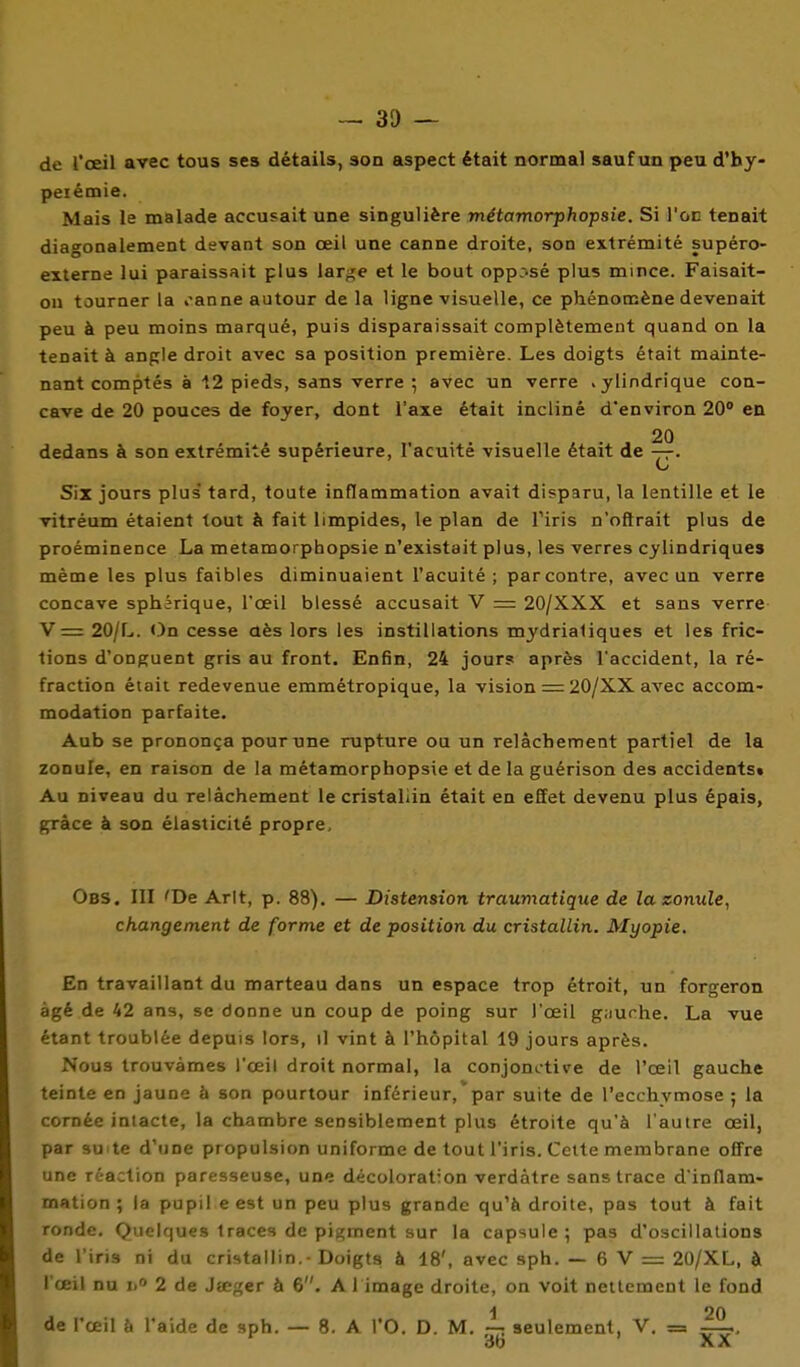 ~ 31) — de l'œil avec tous ses détails, son aspect était normal sauf un peu d'hy- peiémie. Mais le malade accusait une singulière métamorphopsie. Si l'on tenait diagonalement devant son œil une canne droite, son extrémité supéro- exlerne lui paraissait plus large et le bout oppr-sé plus mince. Faisait- on tourner la »'anne autour de la ligne visuelle, ce phénomène devenait peu à peu moins marqué, puis disparaissait complètement quand on la tenait à angle droit avec sa position première. Les doigts était mainte- nant comptés à 12 pieds, sans verre ; avec un verre .ylindrique con- cave de 20 pouces de foyer, dont l'axe était incliné d'environ 20° en 20 dedans à son extrémité supérieure, l'acuité visuelle était de —-. Six jours plus tard, toute inflammation avait disparu, la lentille et le vitréum étaient tout à fait limpides, le plan de l'iris n'oftrait plus de proéminence La metamorphopsie n'existait plus, les verres cylindriques même les plus faibles diminuaient l'acuité ; par contre, avec un verre concave sphàrique, l'œil blessé accusait V = 20/XXX et sans verre V= 20/L. «)n cesse dès lors les instillations mydriatiques et les fric- tions d'onguent gris au front. Enfin, 24 jour? après l'accident, la ré- fraction était redevenue emmétropique, la vision = 20/XX avec accom- modation parfaite. Aub se prononça pour une rupture ou un relâchement partiel de la zonule, en raison de la métamorphopsie et de la guérison des accidents» Au niveau du relâchement le cristallin était en effet devenu plus épais, çrâce à son élasticité propre. Obs. III 'De Arit, p. 88). — Distension traumatique de la zonule, changement de forme et de position du cristallin. Myopie. En travaillant du marteau dans un espace trop étroit, un forgeron âgé de 42 ans, se donne un coup de poing sur l'œil giiuche. La vue étant troublée depuis lors, il vint à l'hôpital 19 jours après. Nous trouvâmes l'œil droit normal, la conjonctive de l'œil gauche teinte en jaune à son pourtour inférieur, par suite de l'ecchymose ; la cornée intacte, la chambre sensiblement plus étroite qu'à l'autre œil, par su te d'une propulsion uniforme de tout l'iris. Celte membrane offre une réaction paresseuse, une décoloration verdàtre sans trace d'inflam- mation; la pupil eest un peu plus grande qu'à droite, pas tout à fait ronde. Quelques traces de pigment sur la capsule ; pas d'oscillations de l'iris ni du cristallin.- Doigts à 18', avec sph. — 6 V = 20/XL, à l'œil nu 1.0 2 de Jœger à 6. A l image droite, on voit nettement le fond 1 20