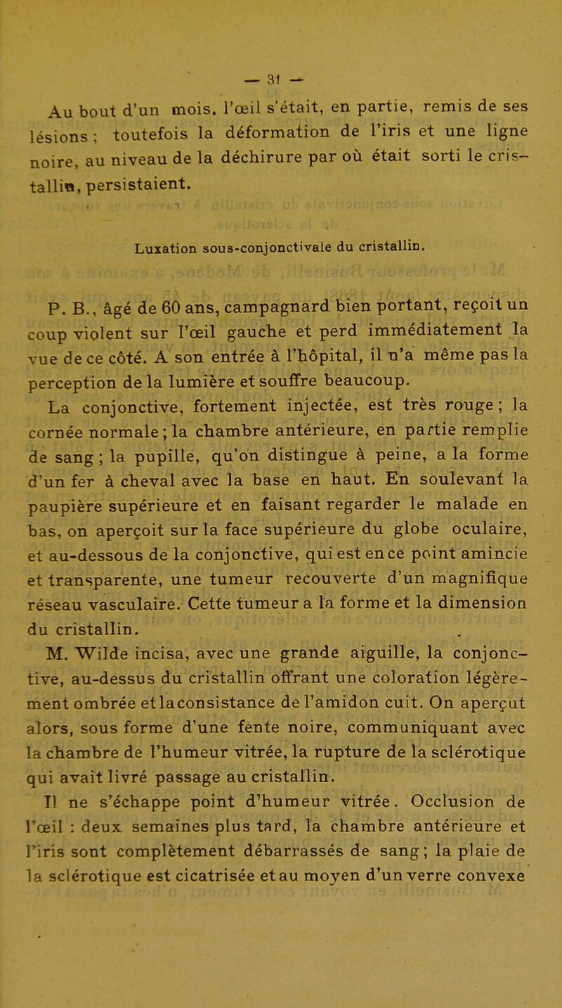 Au bout d'un mois, l'œil s'était, en partie, remis de ses lésions ; toutefois la déformation de l'iris et une ligne noire, au niveau de la déchirure par où était sorti le cris- tallia, persistaient. Luxation sous-conjonctivale du cristallin. P. B., âgé de 60 ans, campagnard bien portant, reçoit un coup violent sur l'œil gauche et perd immédiatement la vue de ce côté. A son entrée à l'hôpital, il n'a même pas la perception de la lumière et souffre beaucoup. La conjonctive, fortement injectée, est très rouge; la cornée normale ; la chambre antérieure, en partie remplie de sang ; la pupille, qu'on distingue à peine, a la forme d'un fer à cheval avec la base en haut. Eh soulevant la paupière supérieure et en faisant regarder le malade en bas, on aperçoit sur la face supérieure du globe oculaire, et au-dessous de la conjonctive, quiestence point amincie et transparente, une tumeur recouverte d'un magnifique réseau vasculaire. Cette tumeur a la forme et la dimension du cristallin. M. Wilde incisa, avec une grande aiguille, la conjonc- tive, au-dessus du cristallin offrant une coloration légère- ment ombrée etlaconsistance de l'amidon cuit. On aperçut alors, sous forme d'une fente noire, communiquant a,vec la chambre de l'humeur vitrée, la rupture de la sclérotique qui avait livré passage au cristallin. Il ne s'échappe point d'humeur vitrée. Occlusion de l'œil : deux semaines plus tard, îa chambre antérieure et l'iris sont complètement débarrassés de sang; la plaie de la sclérotique est cicatrisée et au moyen d'un verre convexe