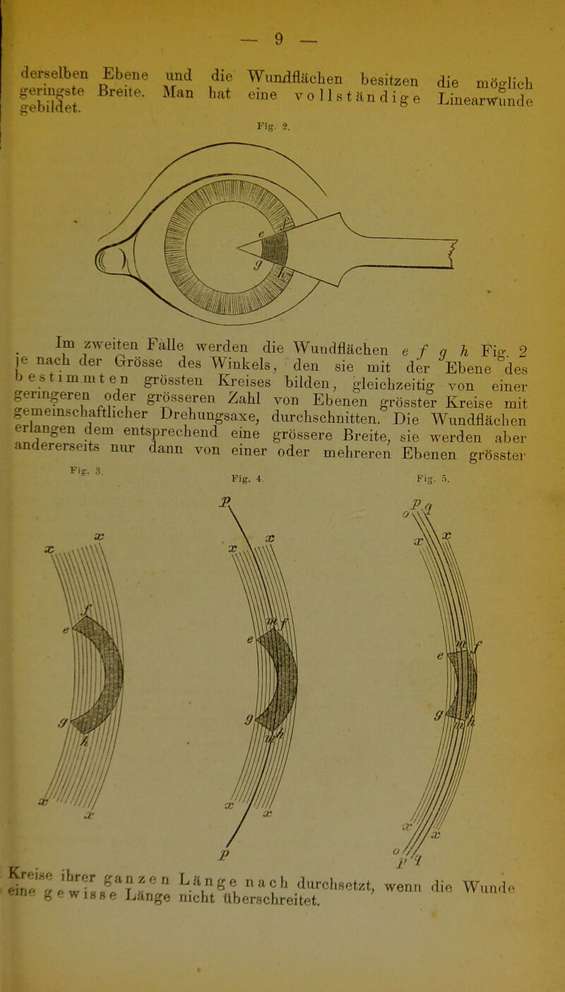 derselben Ebene und die y-eringste Breite. Man hat jrebildet. Wundflächen besitzen die eine vollständige Linearwünde möglich Fig. g h Fig. 2 Ebene des Im zweiten Falle werden die Wuudflächen e f je nach der Grösse des Winkels, den sie mit der bestimmten grössten Kreises bilden, gleichzeitig von emer germgeren oder grösseren Zahl von Ebenen grösster Kreise mit gememschafthcher Drehungsaxe, durchschnitten. Die Wundflächen erlangen dem entsprechend eine grössere Breite, sie werden aber andererseits nm- dann von einer oder mehreren Ebenen grösster Fig. .1 Fig. 4. I''ig. 5. X //// ^n^' :tTss^e'?r L'Yge u^ durchsetzt, wenn die Wunde