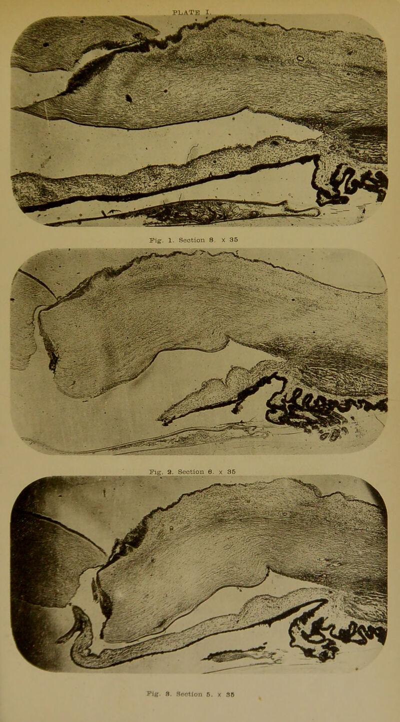 Pig. 1- Section 8 X 35 Pis;, 3. Section 6. x 36 Fig. 8. Section 6. x SB