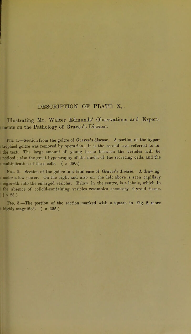 Illustrating Mr. Walter Edmunds' Observations and Experi- ments on the Pathology of Graves's Disease. Fig. 1.—Section from the goitre of Graves's disease. A. portion of the hyper- trophied goitre was removed by operation ; it is the second case referred to in the text. The large amount of young tissue between the vesicles will be noticed; also the great hypertrophy of the nuclei of the secreting cellSj and the multiplication of these cells. ( x 380.) Fig. 2.—Section of the goitre in a fatal case of Graves's disease. A drawing under a low power. On the right and also on the left above is seen capillary ingrowth into the enlarged vesicles. Below, in the centre, is a lobule, which in the absence of colloid-containing vesicles resembles accessory thyroid tissue. ( X 25.) Fig. 3.—The portion of the section marked with a square in Fig. 2, more ' highly magnified. ( x 225.)