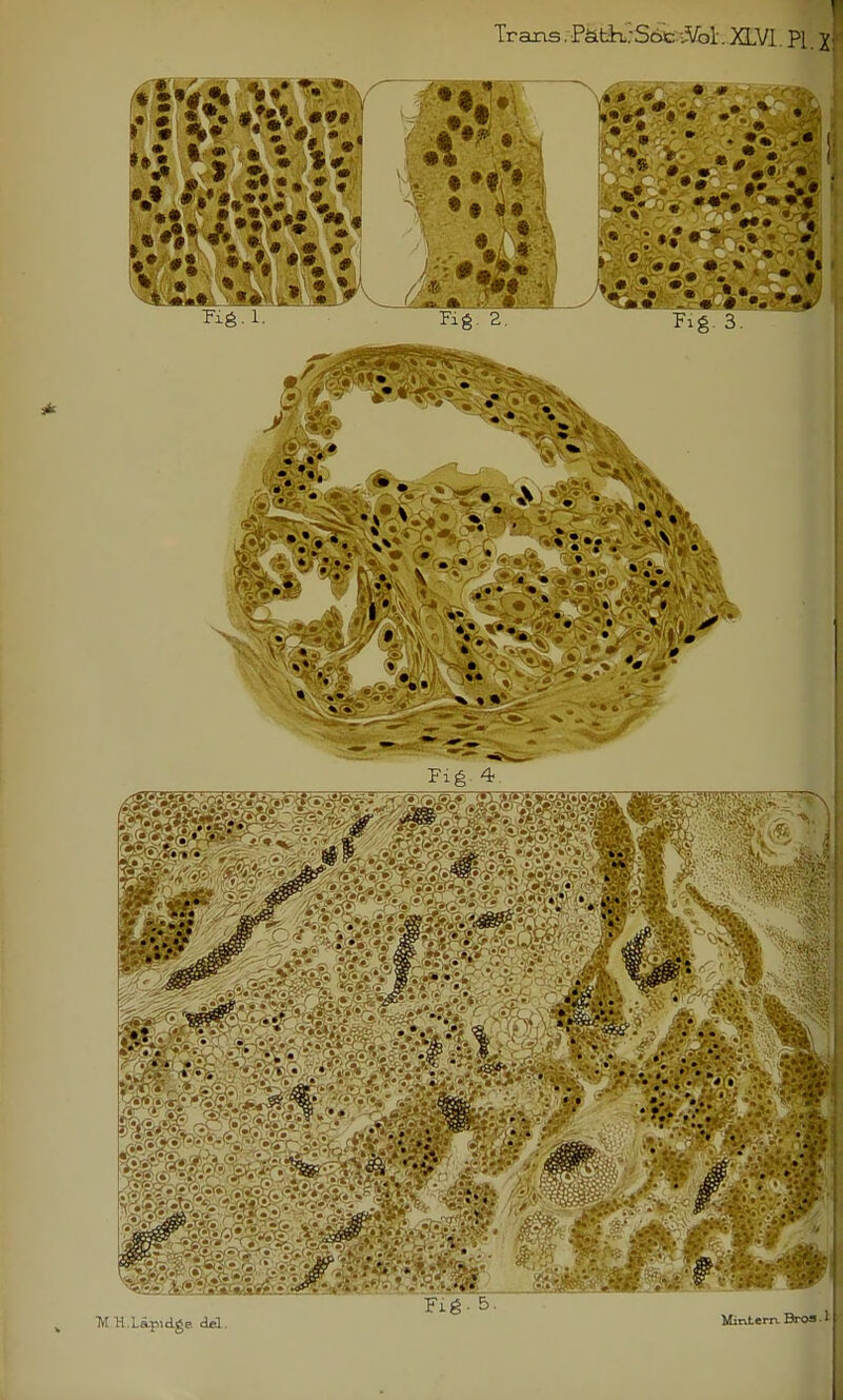 Trans. PktkrS*^-:-;.^!-. XLVl. PI X; Fig. 3. I' 0 X « « Fig 4