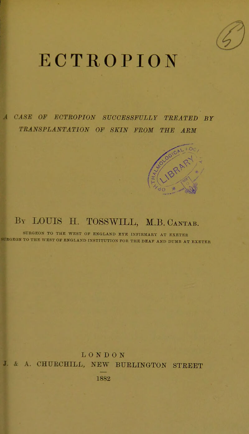 CASE OF ECTROPION SUCCESSFULLY TREATED BY TRANSPLANTATION OF SKIN FROM THE ARM Bv LOUIS H. TOSSWILL, M.B.Cantab. SORGEON TO THE WEST OF ENGLAND KYK INFIRMARY AT EXF.TER OEOS TO THR WEST OF ENGLAND INSTITUTION FOR THE DEAF AND DUMB AT EXETKK LONDON & A. CHURCHILL, NEW BURLINGTON STREET 1882