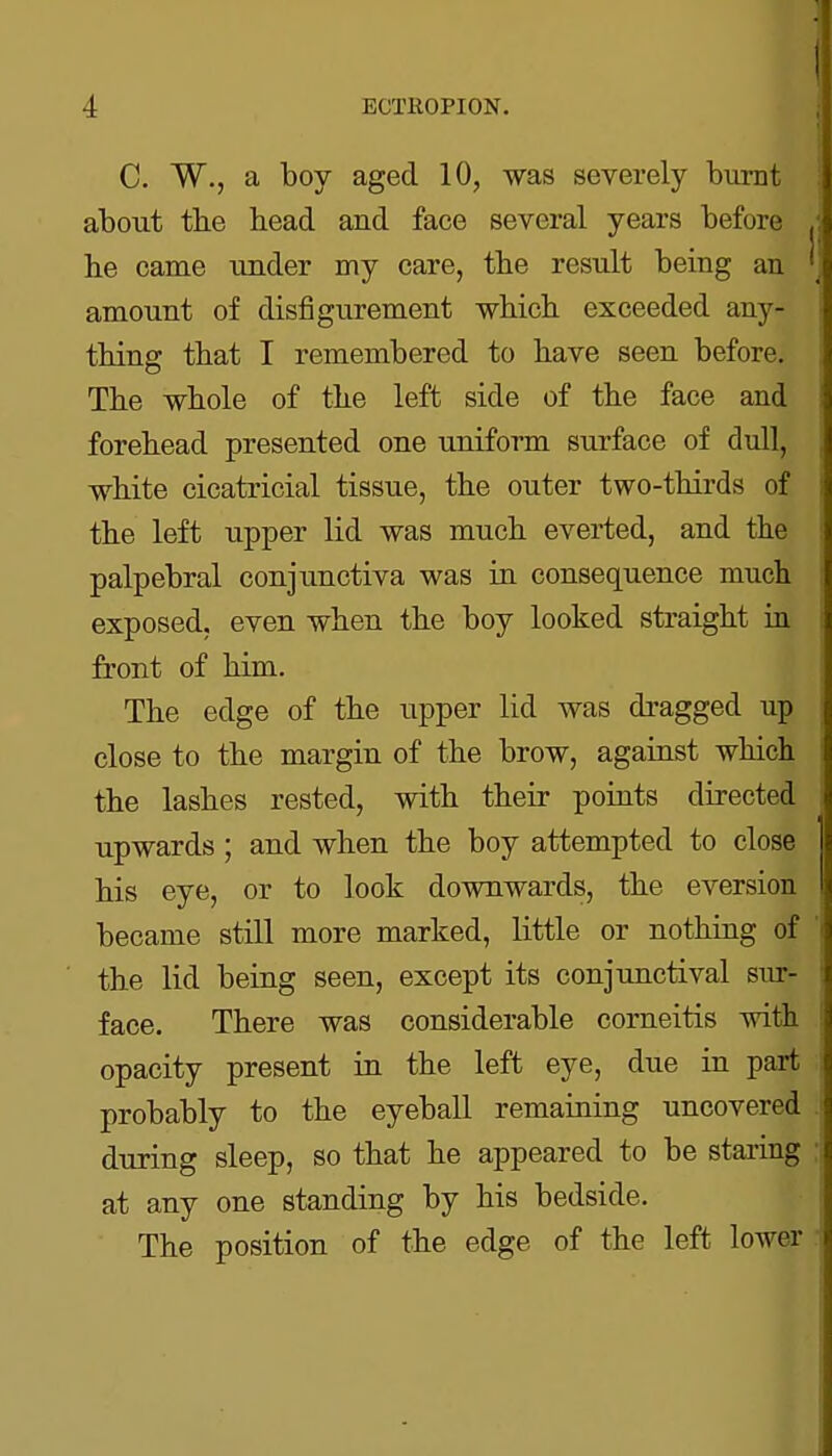 C. W., a boy aged 10, was severely burnt about the head and face several years before he came under my care, the result being an amount of disfigurement which exceeded any- thing that I remembered to have seen before. The whole of the left side of the face and forehead presented one uniform surface of dull, white cicatricial tissue, the outer two-thirds of the left upper lid was much everted, and the palpebral conjunctiva was in consequence much exposed, even when the boy looked straight in front of him. The edge of the upper lid was dragged up close to the margin of the brow, against which the lashes rested, with their points directed upwards; and when the boy attempted to close his eye, or to look downwards, the eversion became still more marked, little or nothing of the lid being seen, except its conjunctival sur- face. There was considerable corneitis with opacity present in the left eye, due in part probably to the eyeball remaining uncovered during sleep, so that he appeared to be stai'ing at any one standing by his bedside. The position of the edge of the left lower