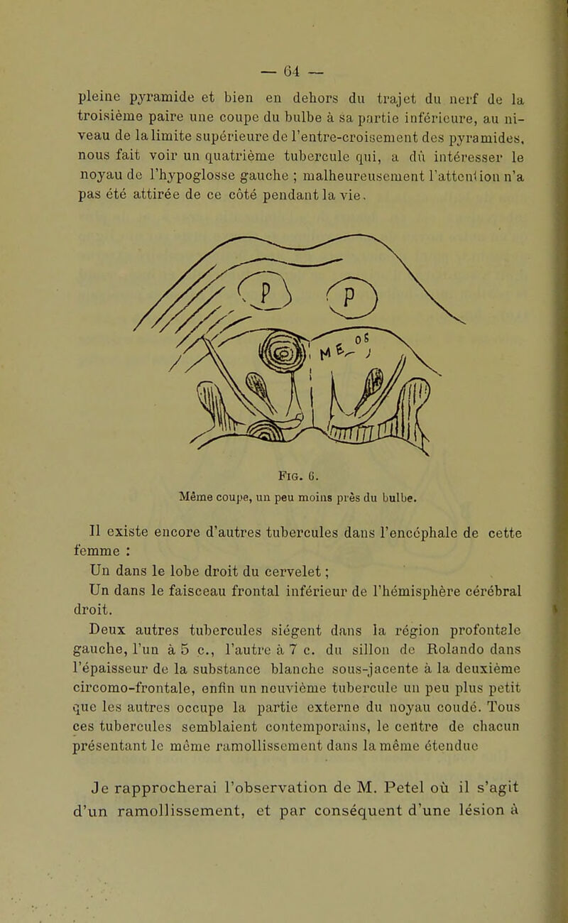 pleine pyramide et bien en dehors du trajet du nerf de la troisième paire une coupe du bulbe à sa partie inférieure, au ni- veau de la limite supérieure de l'entre-croisement des pyramides, nous fait voir un quatrième tubercule qui, a dû intéresser le noyau de l'hypoglosse gauche ; malheureusement l'attcnUon n'a pas été attirée de ce côté pendant la vie. FiG. G. Même coupe, un peu moins près du bulbe. Il existe encore d'autres tubercules dans l'encéphale de cette femme : Un dans le lobe droit du cervelet ; Un dans le faisceau frontal inférieur de l'hémisphère cérébral droit. Deux autres tubercules siègent dans la région profontsle gauche, l'un à 5 c., l'autre à 7 c. du sillon do Rolande dans l'épaisseur de la substance blanche sous-jacente à la deuxième cii'como-frontale, enfin un neuvième tubercule un peu plus petit que les autres occupe la partie externe du noyau coudé. Tous ces tubercules semblaient contemporains, le centre de chacun présentant le même ramollissement dans la même étendue Je rapprocherai l'observation de M. Petel où il s'agit d'un ramollissement, et par conséquent d'une lésion à