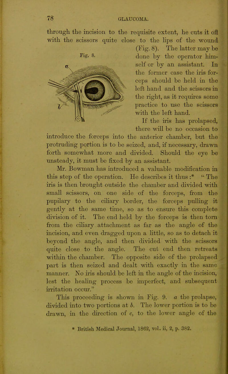 tbrough the incision to the requisite extent, he cuts it ofi with the scissors quite close to the hps of the wound (Fig. 8). The latter may be ^is- 8. done by the operator him- self or by an assistant. In the former case the iris for- ceps should be held in the left hand and the scissors ia the right, as it requires some practice to use the scissors with the left hand. If the iris has prolapsed, there will be no occasion to iatroduce the forceps iato the anterior chamber, but the protruding portion is to be seized, and, if necessary, di-awn forth somewhat more and divided. Should the eye be unsteady, it must be fixed by an assistant. Mr. Bowman has iatroduced a valuable modification in this step of the operation. He describes it thus :*  The iris is then brought outside the chamber and divided with small scissors, on one side of the forceps, from the pupilary to the ciliary border, the forceps pulling it gently at the same time, so as to ensm-e this complete division of it. The end held by the forceps is then torn from the cihary attachment as far as the angle of the incision, and even dragged upon a Httle, so as to detach it beyond the angle, and then divided vnth. the scissors quite close to the angle. The cut end then retreats within the chamber. The opposite side of the prolapsed part is then seized and dealt with exactly in the same manner. No iris should be left in the angle of the iacision, lest the healing process be imperfect, and subsequent in-itation occm*. This proceeding is shown in Fig. 9. a the prolapse, divided into two portions at b. The lower portion is to be drawn, in the direction of c, to the lower angle of the * British Medical Journal, 1862, vol. ii, 2, p. 382.