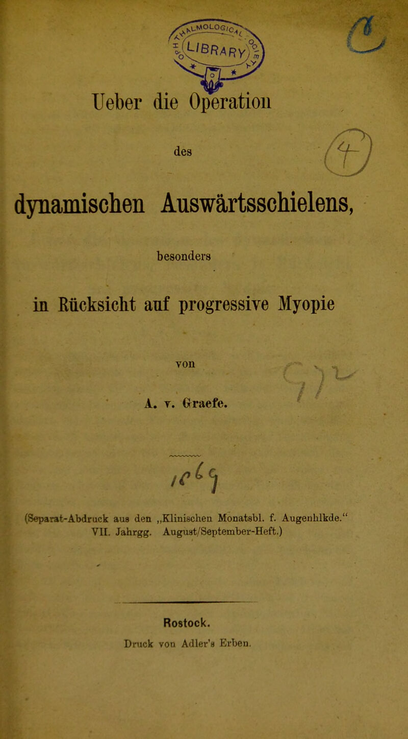 Ueber die Operation des dynamischen Auswärtsschielens, besonders in Rücksicht auf progressive Myopie von ^ _ A. y. Graefe. (Separat-Abdruck aus den „Klinischen Monatsbl. f. Augenhlkde. VII. Jahrgg. August/September-Heft.) Rostock. Druck von Adler'a Erben.