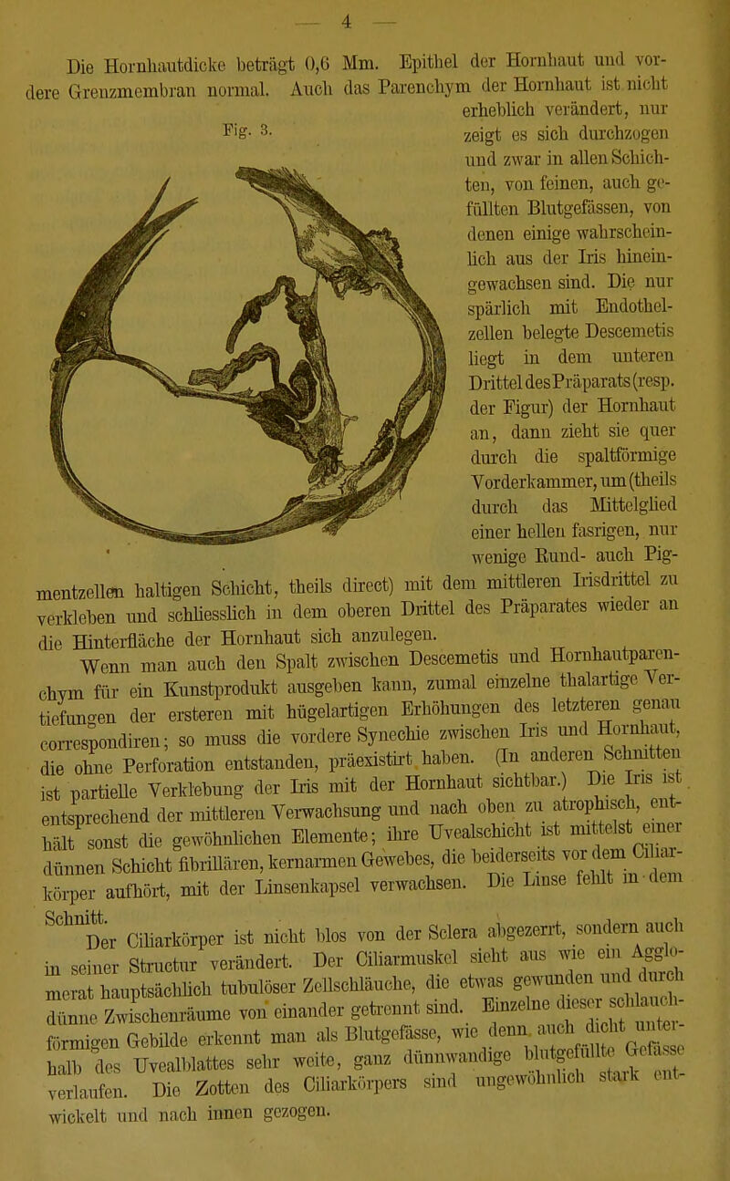 Die Hornhautdicke beträgt 0,6 Mm. Epithel der Hornhaut und vor- dere Grenzmembran normal. Auch das Parenchym der Hornhaut ist nicht erheblich verändert, nur 3- zeigt es sich durchzogen und zwar in allen Schich- ten, von feinen, auch ge- füllten Blutgefässen, von denen einige wahrschein- lich aus der Iris hinein- gewachsen sind. Die nur spärlich mit Endothel- zellen belegte Descemetis liegt in dem unterm Drittel desPräparats (resp. der Figur) der Hornhaut an, dann zieht sie quer durch die spaltförmige Vorderkammer, um (theils durch das Mittelglied einer hellen fasrigen, nur wenige Rund- auch Pig- mentzellen haltigen Schicht, theils direct) mit dem mittleren Irisdrittel zu verkleben und schliesslich in dem oberen Drittel des Präparates wieder an die Hinterfläche der Hornhaut sich anzulegen. Wenn man auch den Spalt zwischen Descemetis und Horuhautparen- chvm für ein Kunstprodukt ausgehen kann, zumal einzelne thalartige Ver- tiefungen der ersteren mit hügelartigen Erhöhungen des letzteren genau correspondiren; so muss die vordere Synechie zwischen Iris und Hornhaut, die ohne Perforation entstanden, präexistirt haben. (In anderen Schmtteu ist partielle Verklebung der Iris mit der Hornhaut sichtbar. Die Ins ist entsprechend der mittleren Verwachsung und nach oben zu atrophisch, ent- hält sonst die gewöhnlichen Elemente; ihre Uvealschicht ist mittot emei dünnen Schicht fibrillären, kernarmen Gewebes, die beiderseits vor dem Cüiar- k^er aufhört, mit der Linsenkapsel verwachsen. Die Linse fehlt in dem SChllDer Ciharkörper ist nicht blos von der Sclera ahgezerrt, sondern auch in seiner Structur verändert. Der Ciliarmuskel sieht aus wie ein Agglo- ^qWte tübulöser Zellschläuche, die etwas gewunden un durch 22 Zwischenräume von einander getrennt sind. Einzelne dieser sei a - förmigen Gebilde erkennt mau als Blutgefässe, wie denn auch_dicht untei halb des TJvealblattes sehr weite, ganz dünnwandig, bktgefmle Odto verlaufen. Die Zotten des Oiliarkörpers sind angewohnlich stajk ent- wickelt und nach innen gezogen.